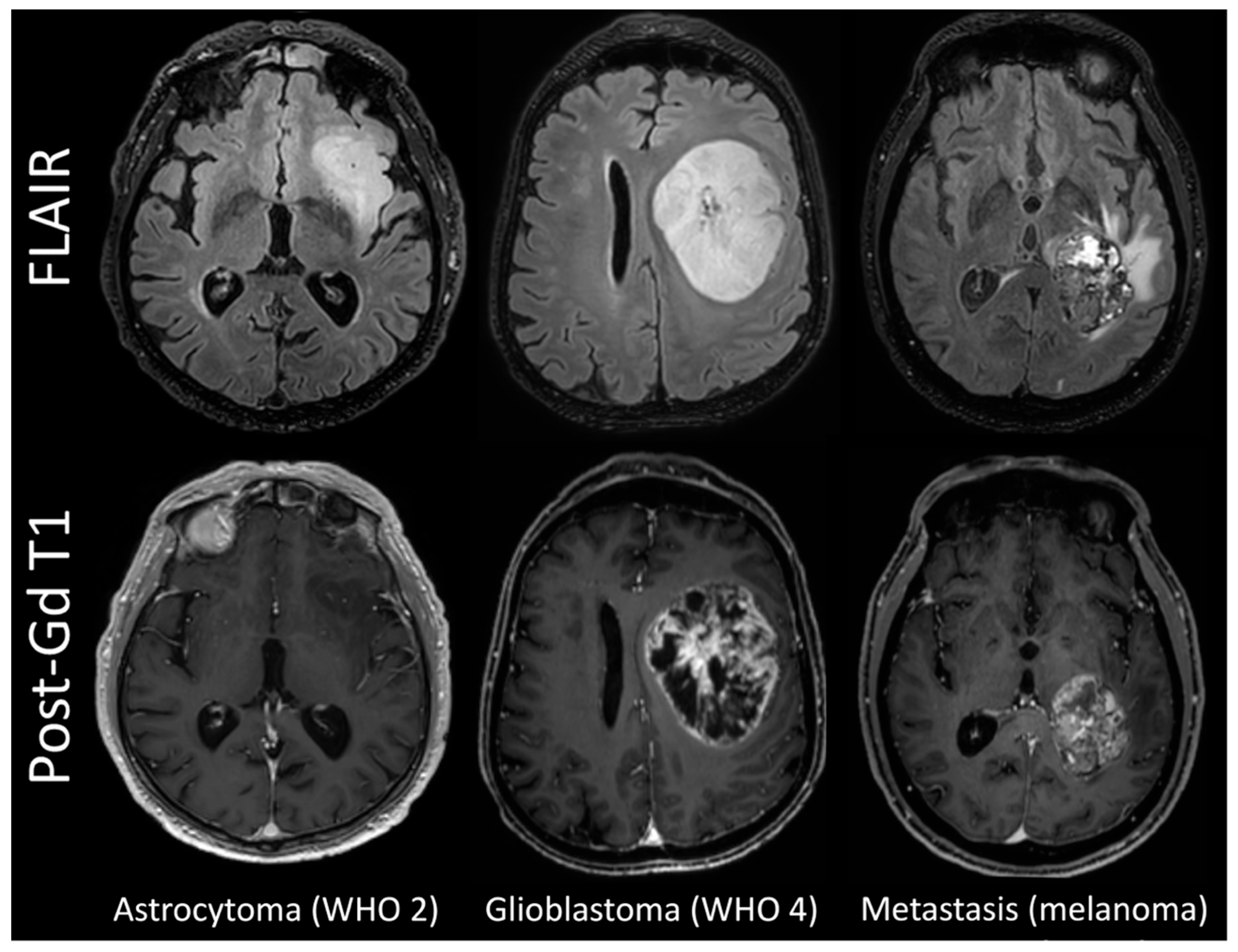 Cancers 15 02490 g001