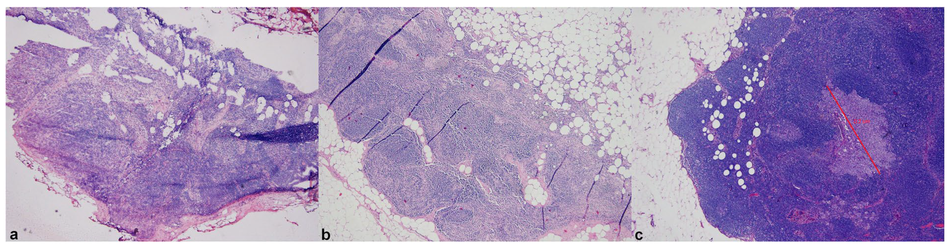 Cancers 15 02491 g001