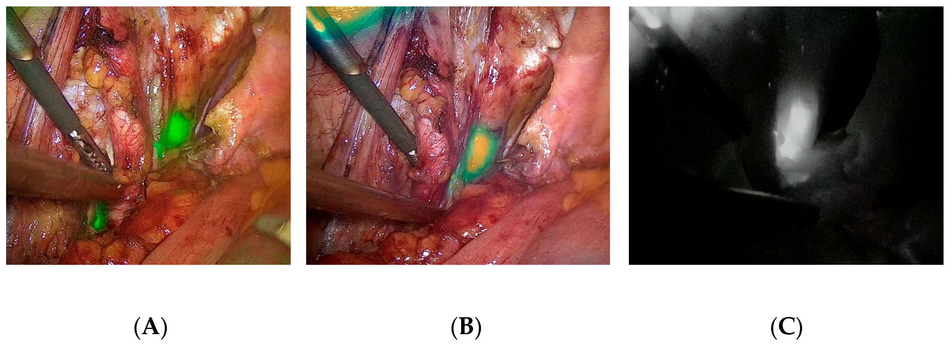 Cancers 15 02495 g001