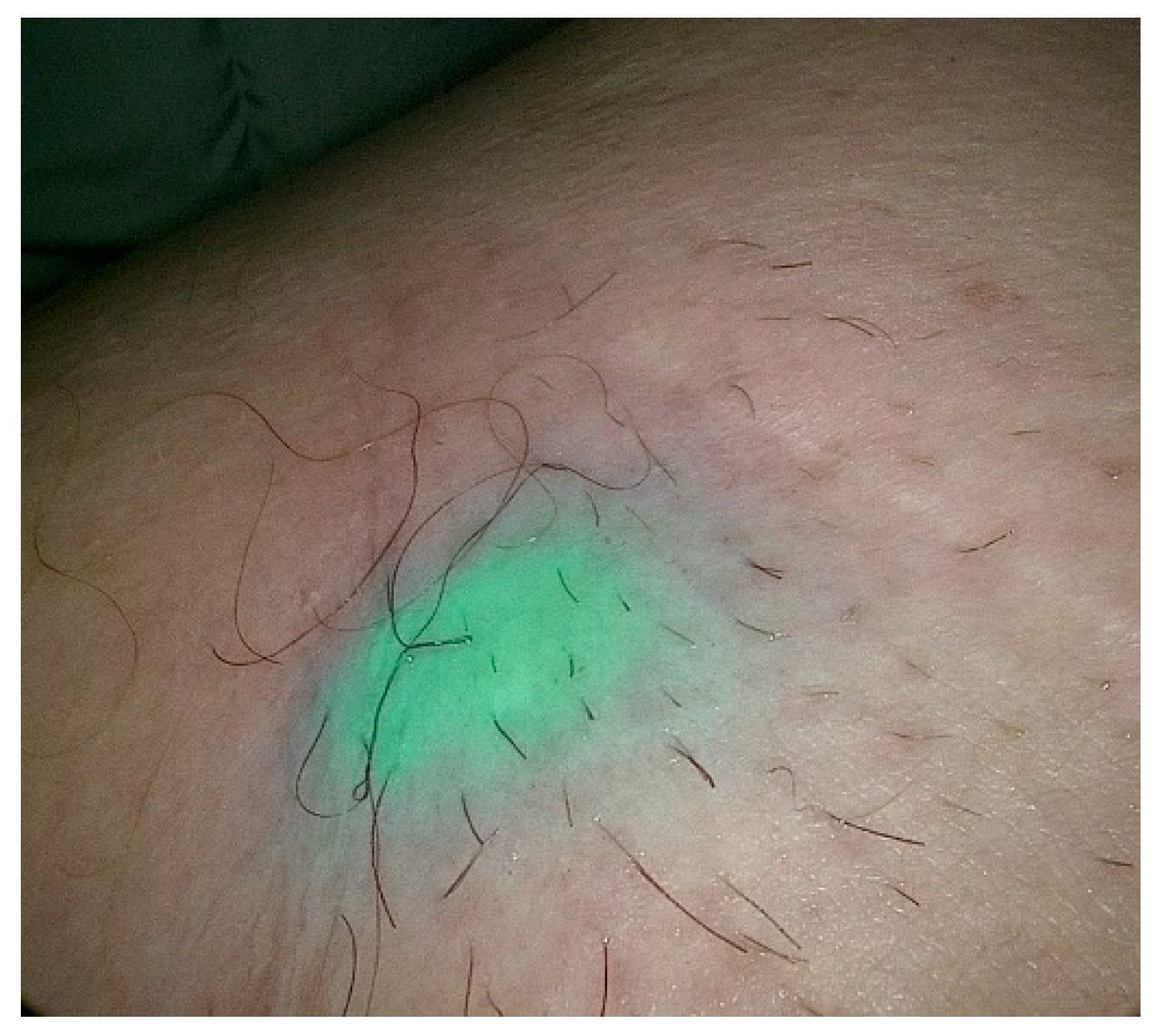 Cancers 15 02495 g002