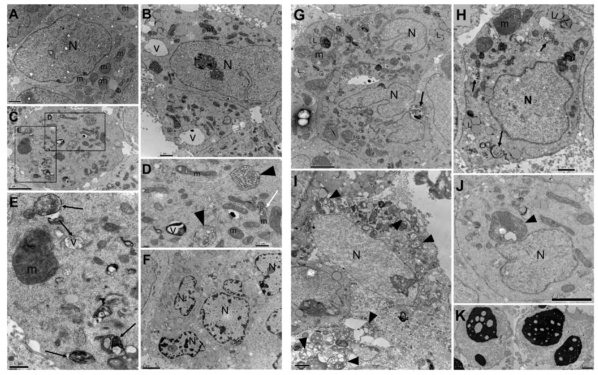 Cancers 15 02544 g003 Cancers 15 02544 g003