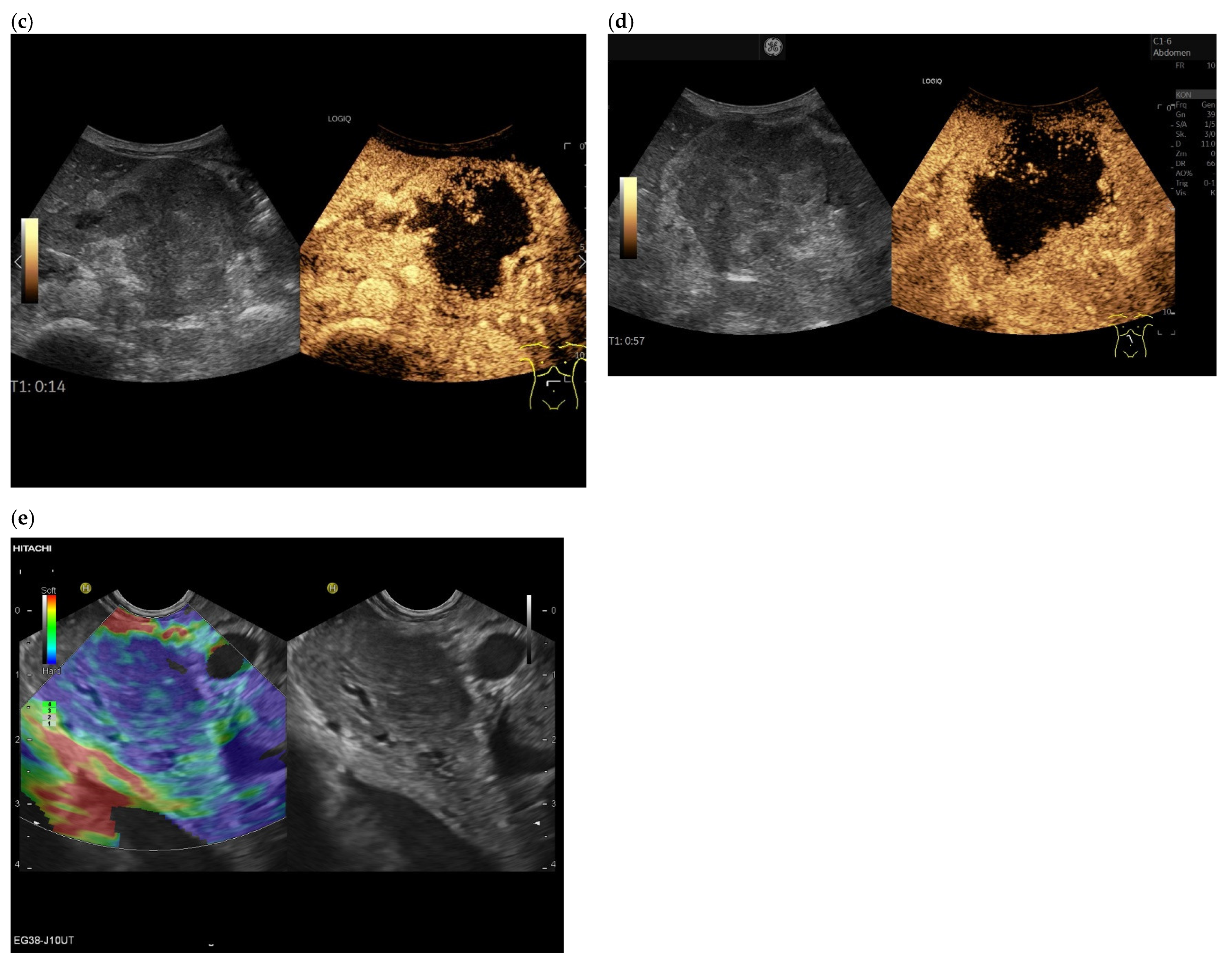 Cancers 15 02546 g001b