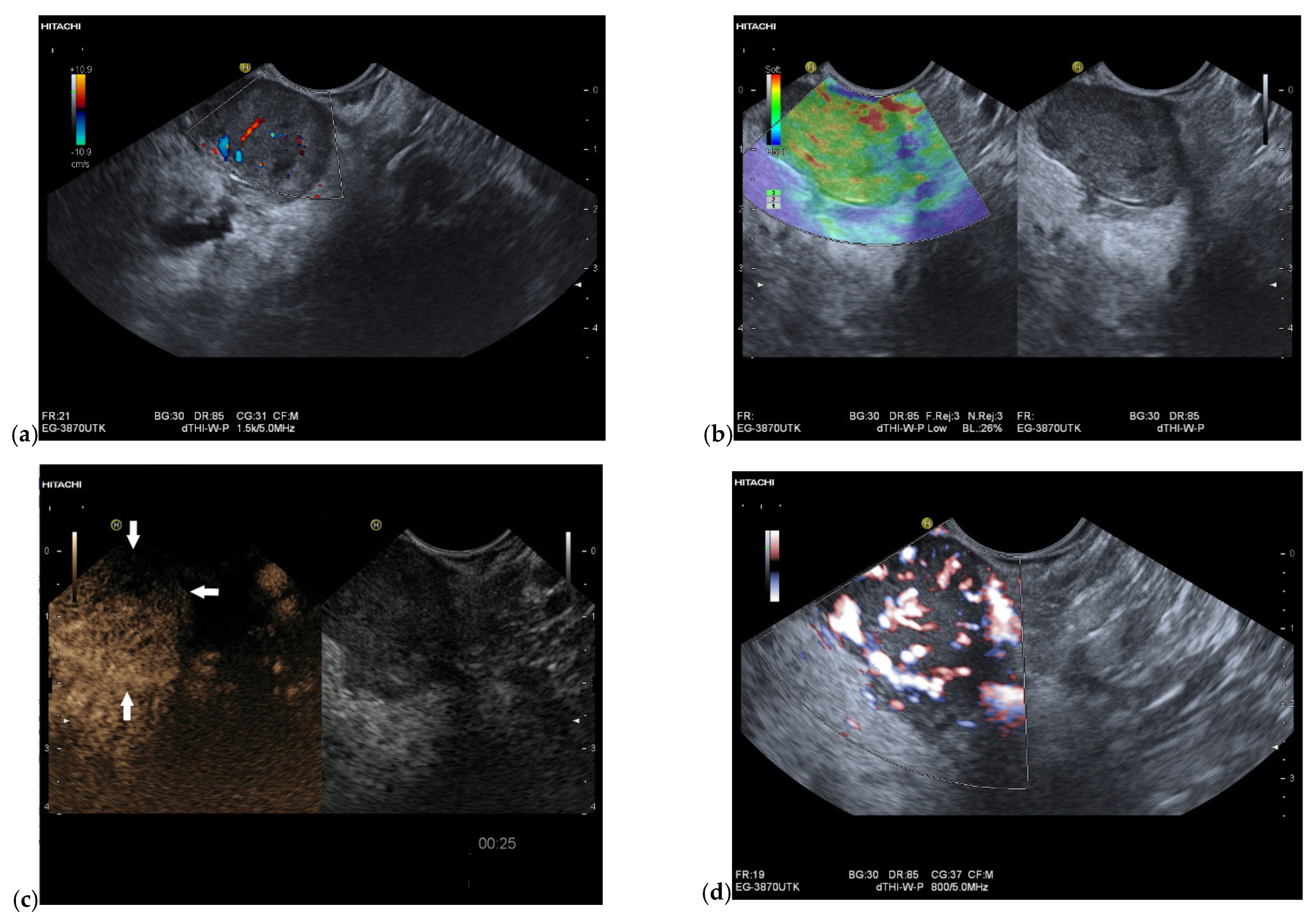 Cancers 15 02546 g002