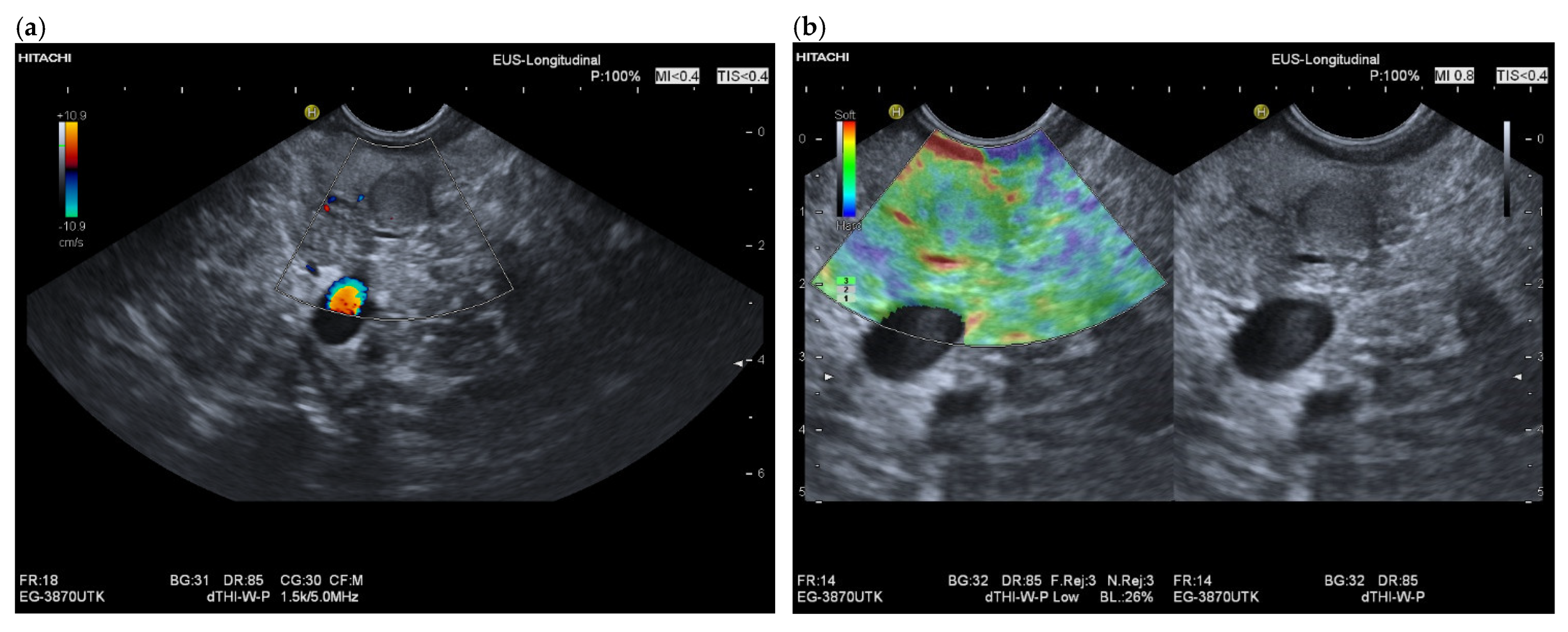 Cancers 15 02546 g003a