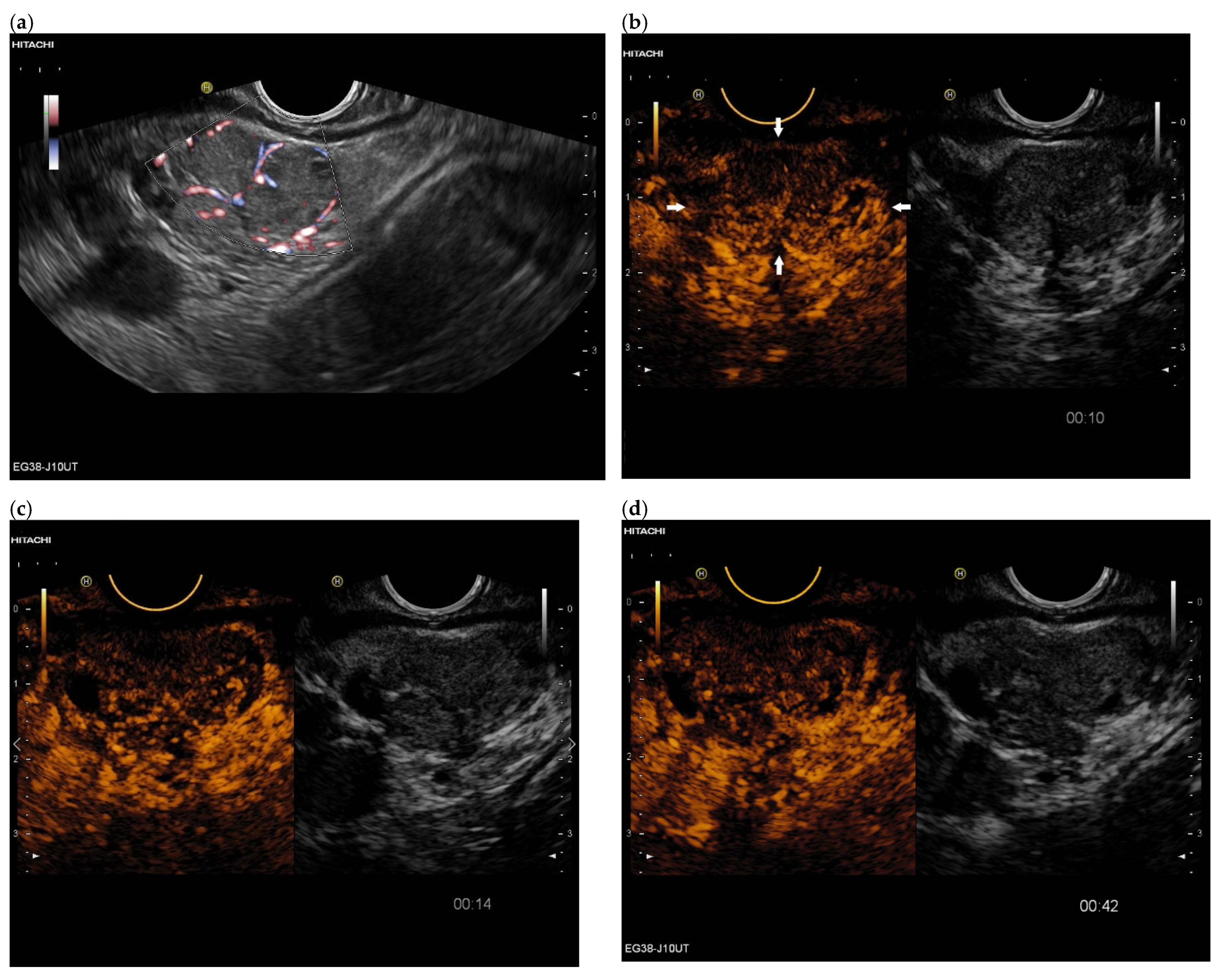 Cancers 15 02546 g005