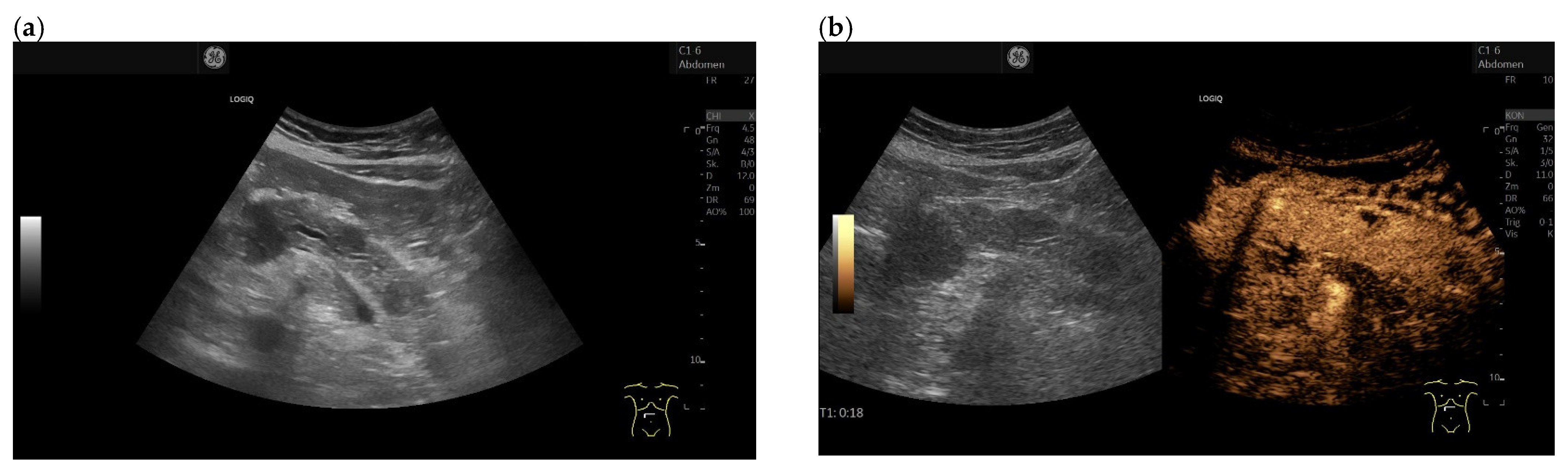 Cancers 15 02546 g006a
