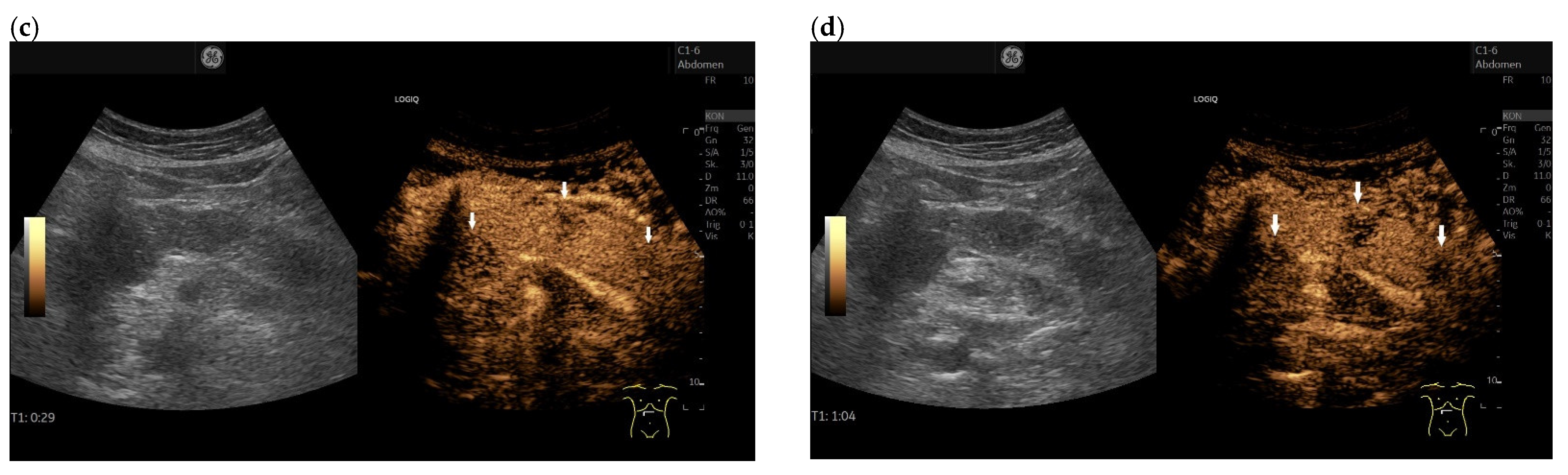 Cancers 15 02546 g006b