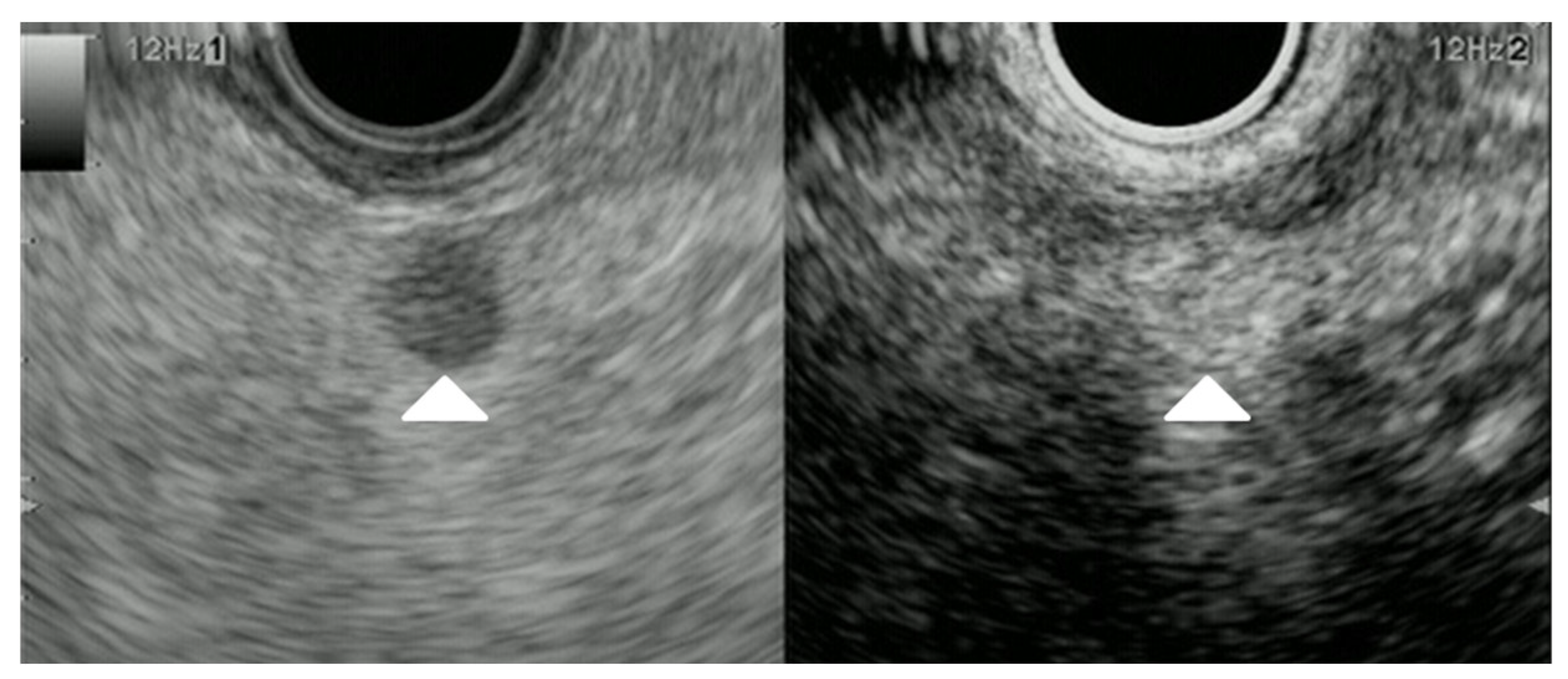 Cancers 15 02546 g008