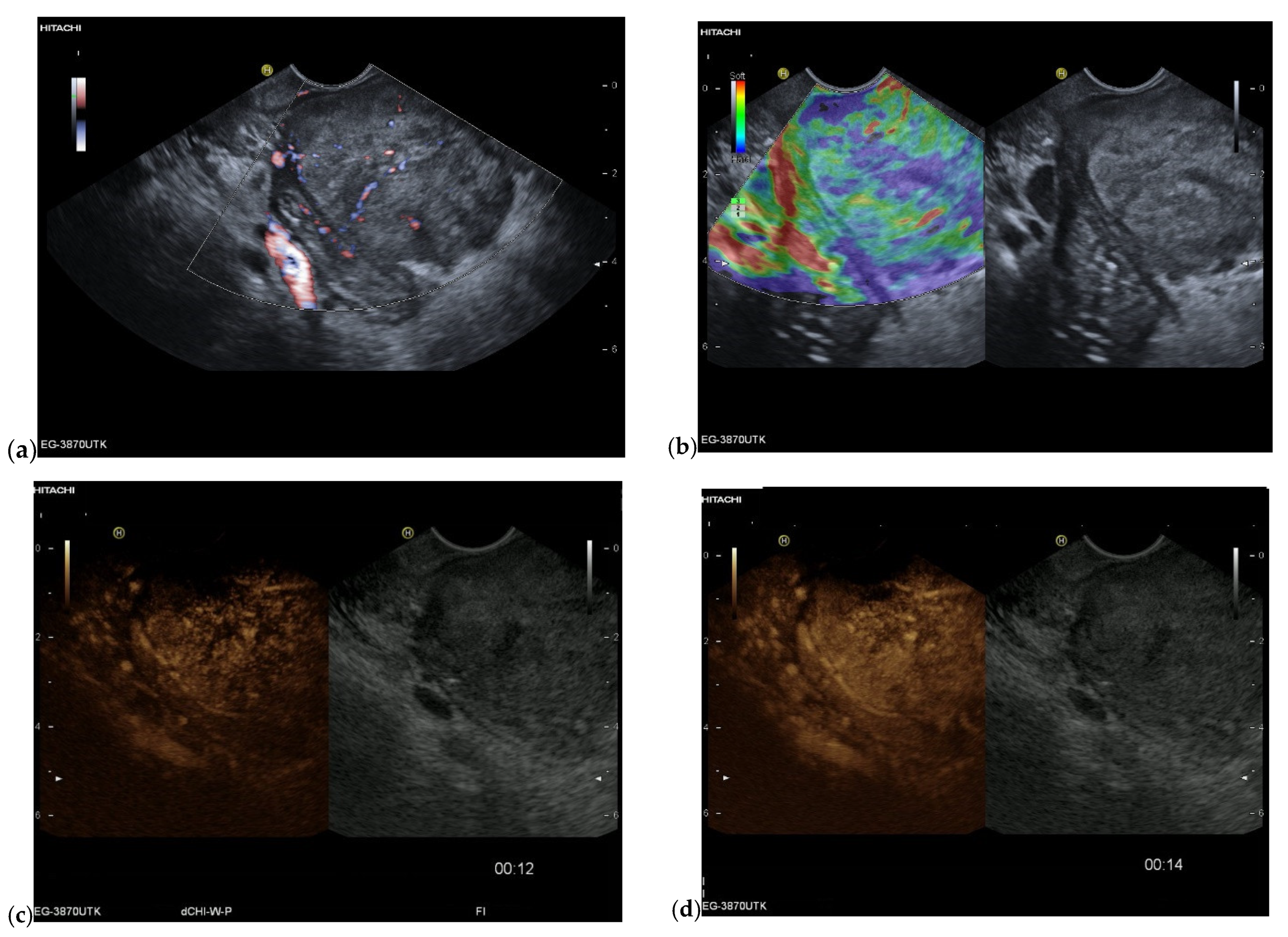 Cancers 15 02546 g009