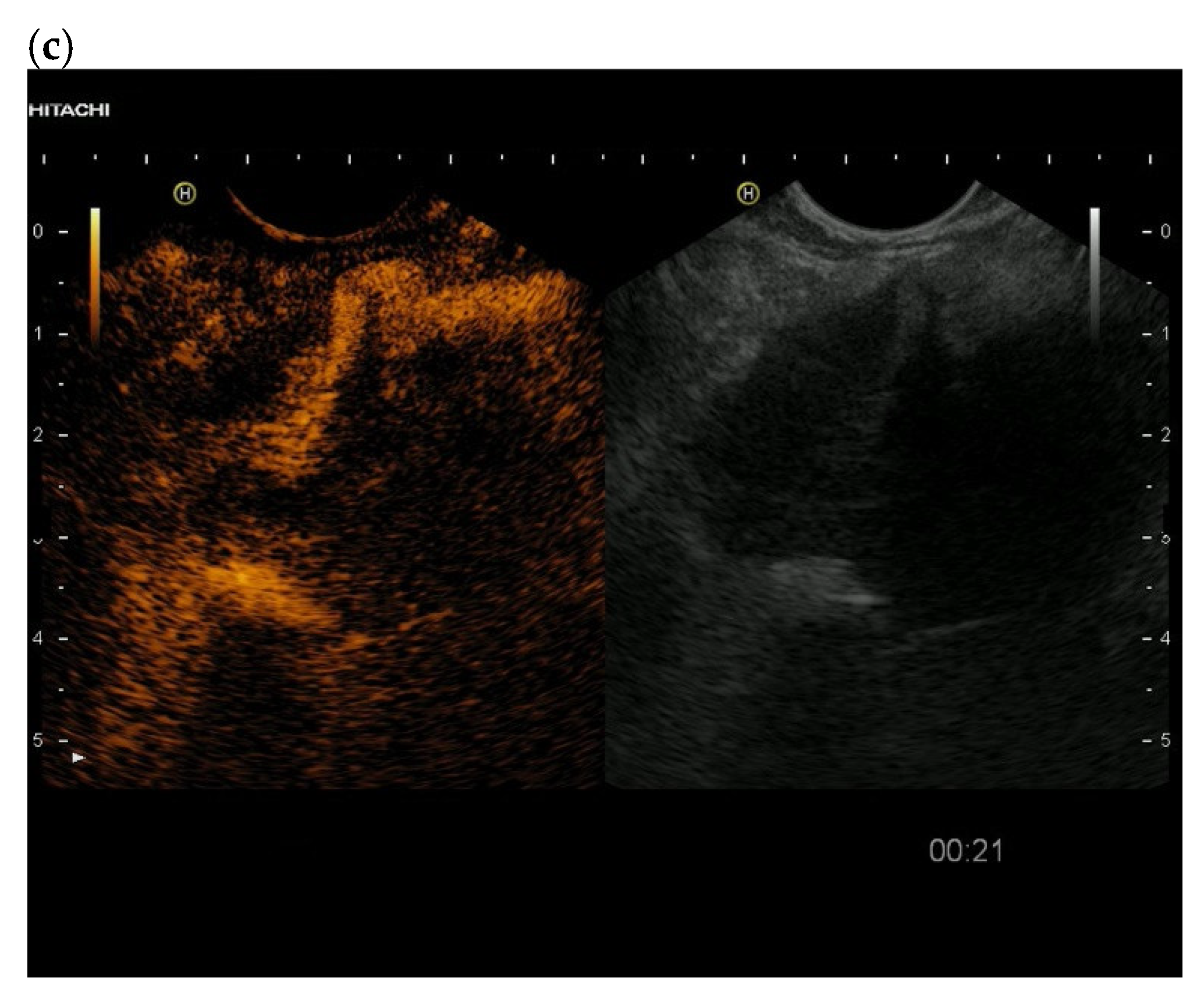 Cancers 15 02546 g010b