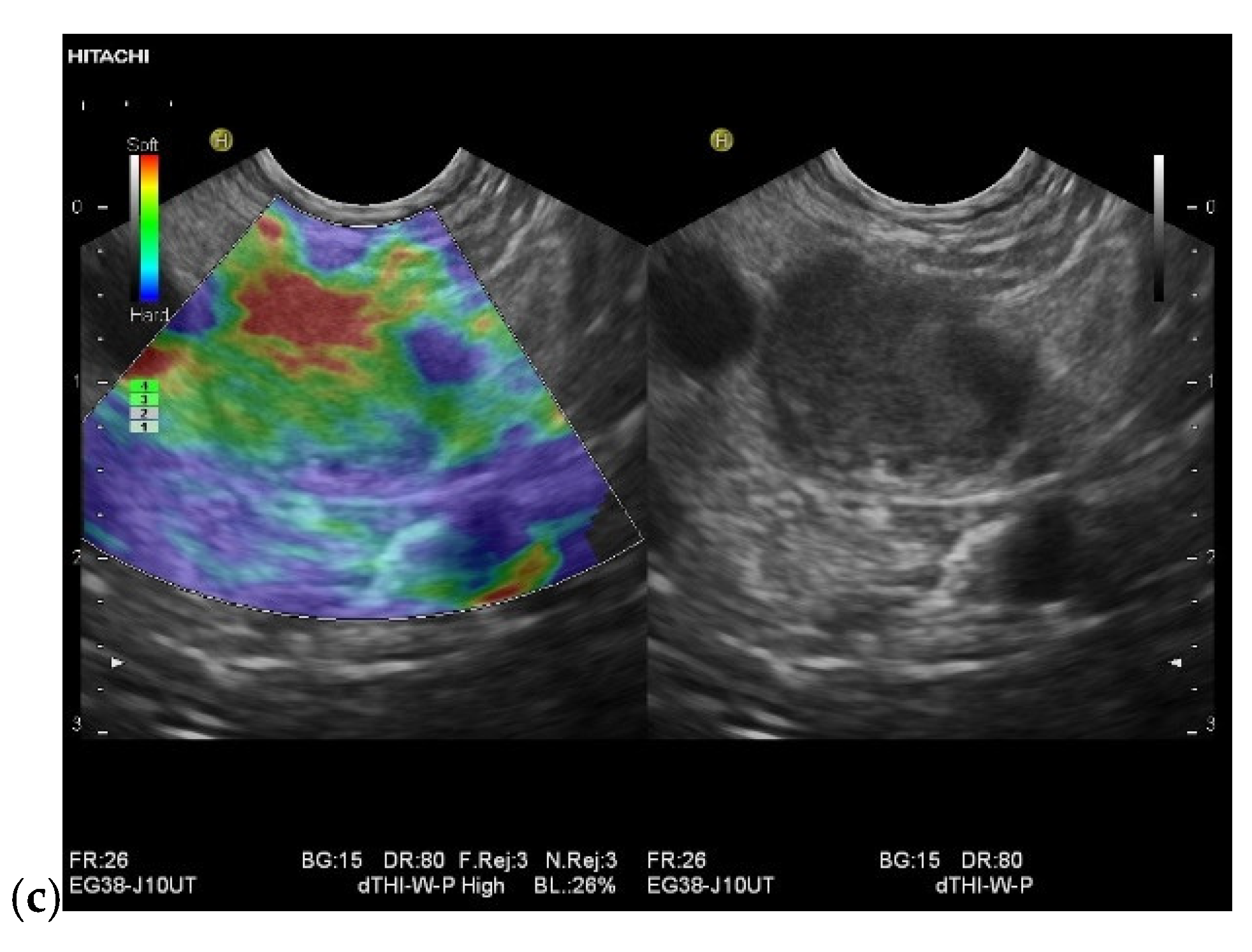 Cancers 15 02546 g011b