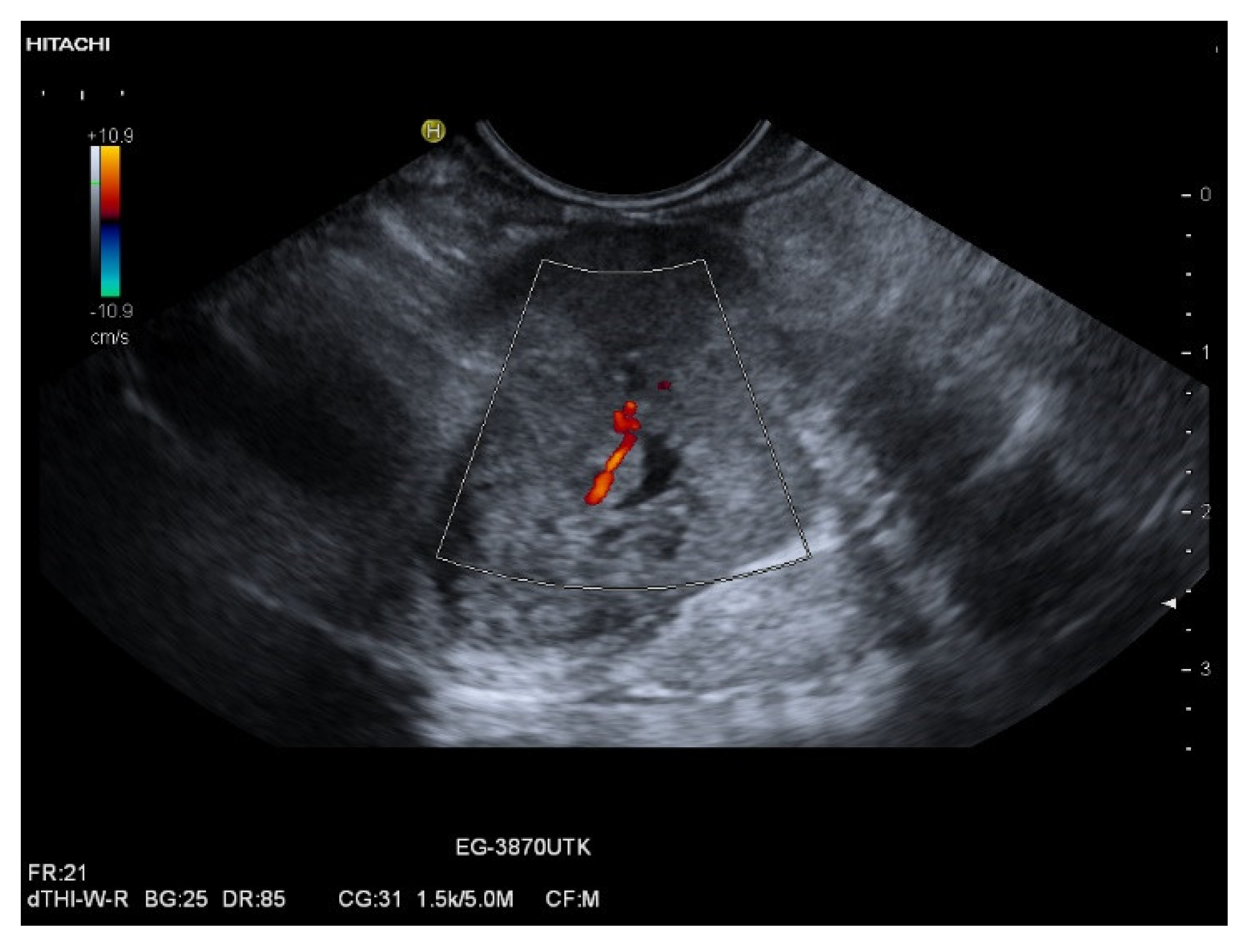 Cancers 15 02546 g012