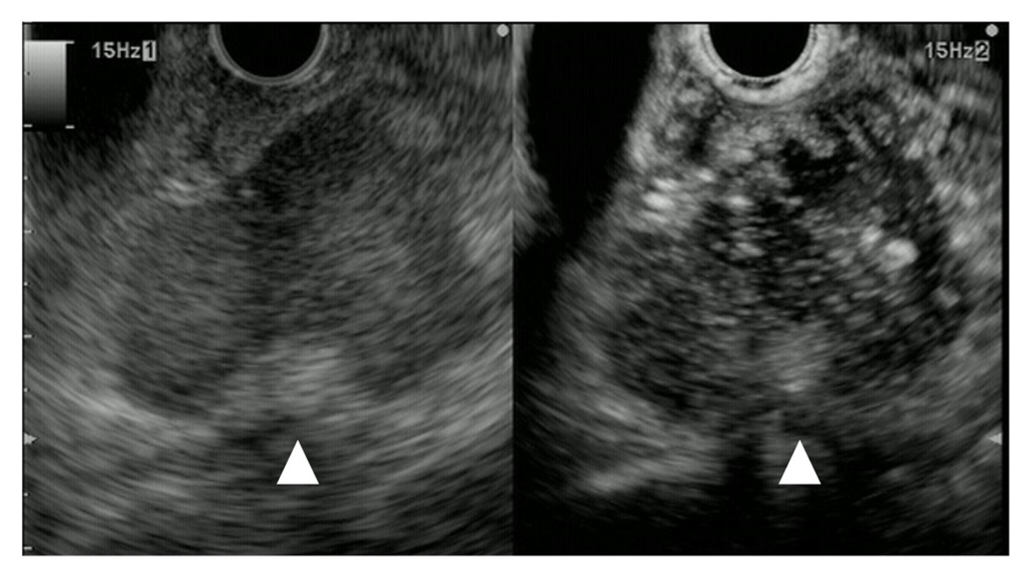 Cancers 15 02546 g013