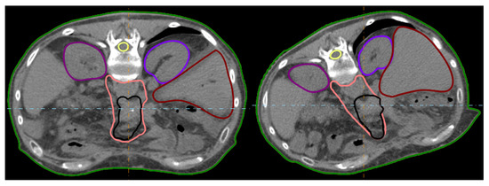 Cancers 15 02550 g0a1