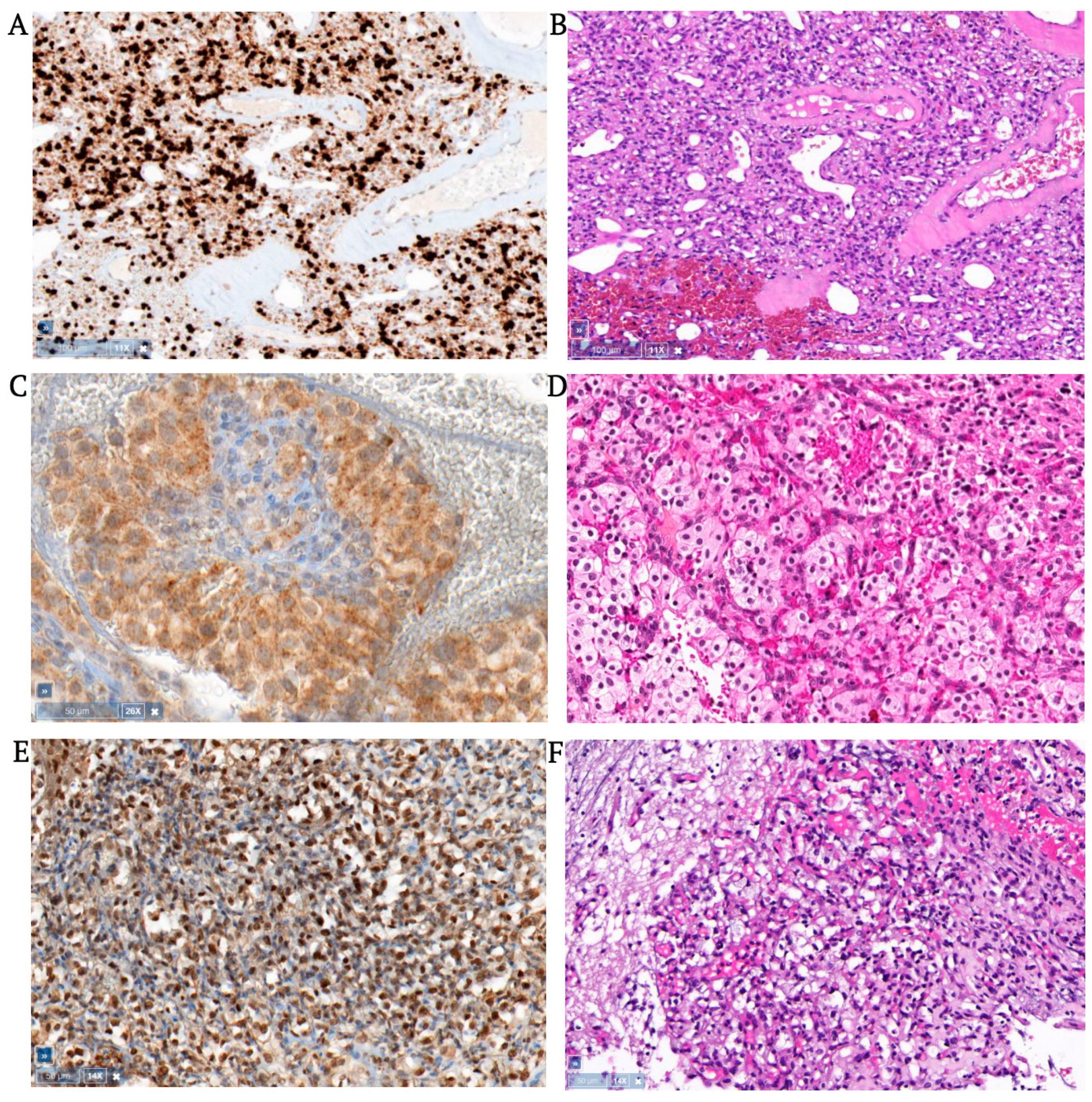 Cancers 15 02551 g001