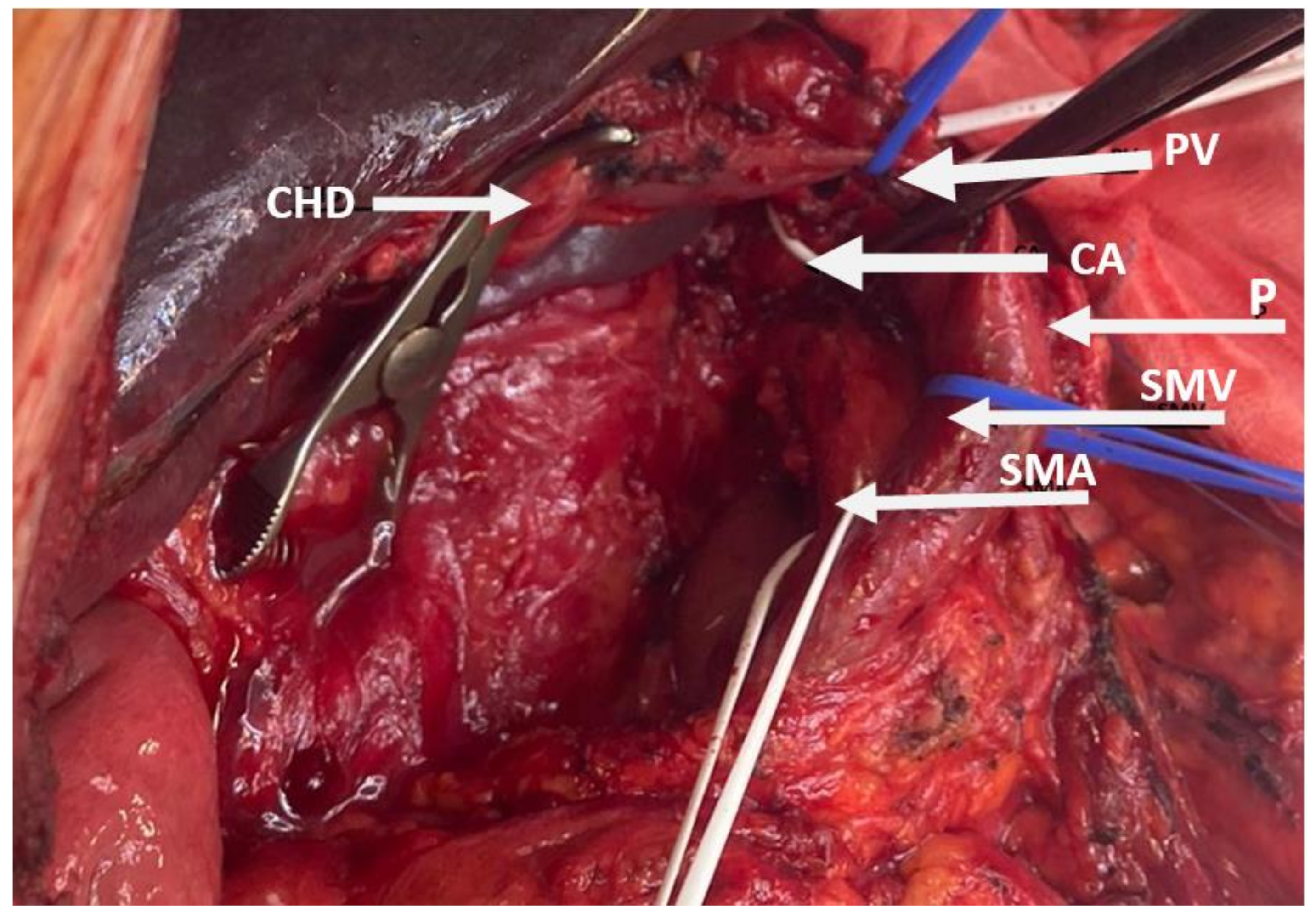 Cancers 15 02584 g002b