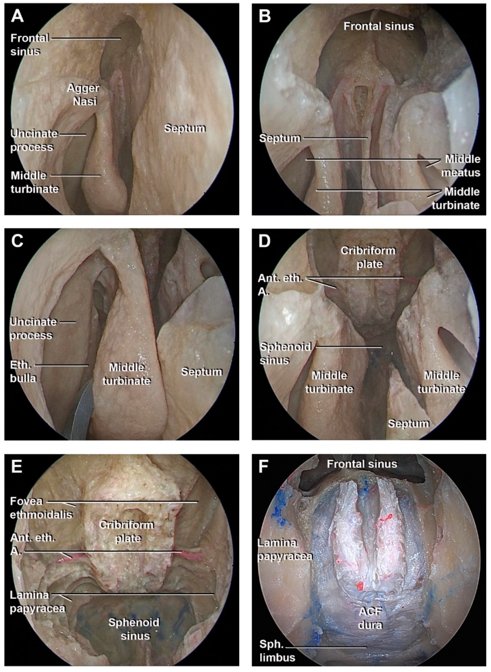 Cancers 15 02587 g003