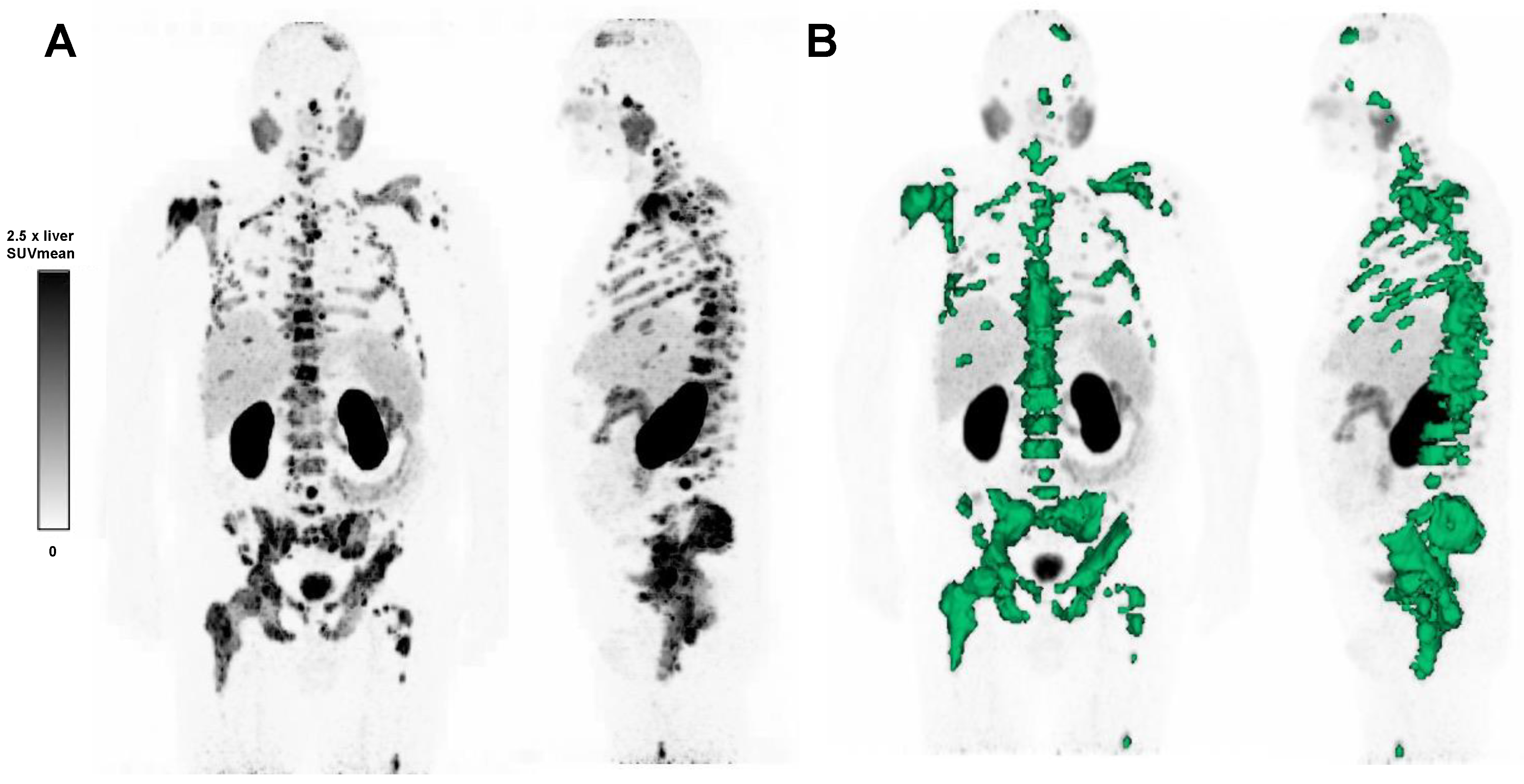 Cancers 15 02592 g001