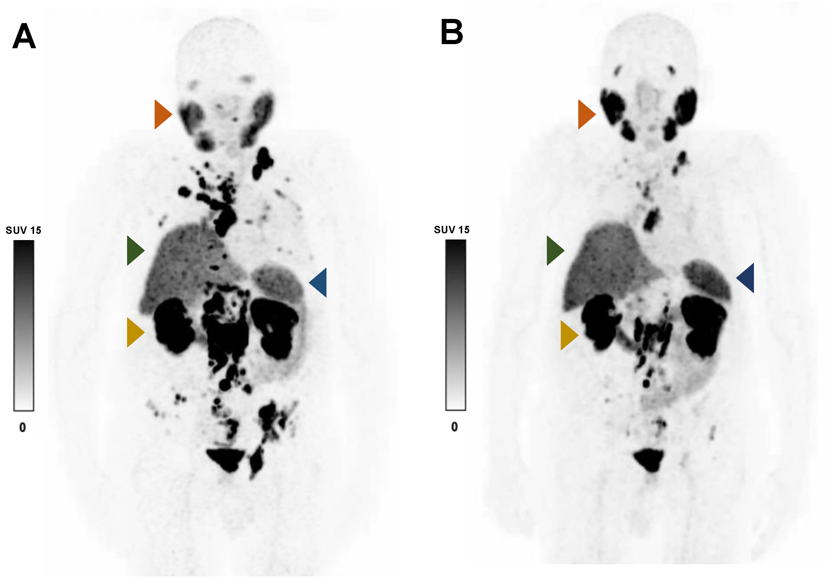 Cancers 15 02592 g004