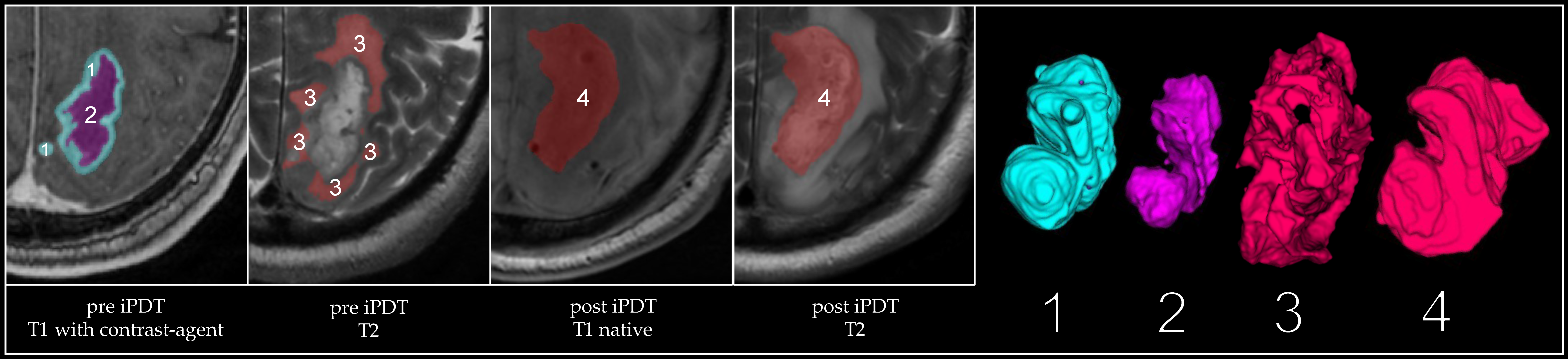 Cancers 15 02603 g001
