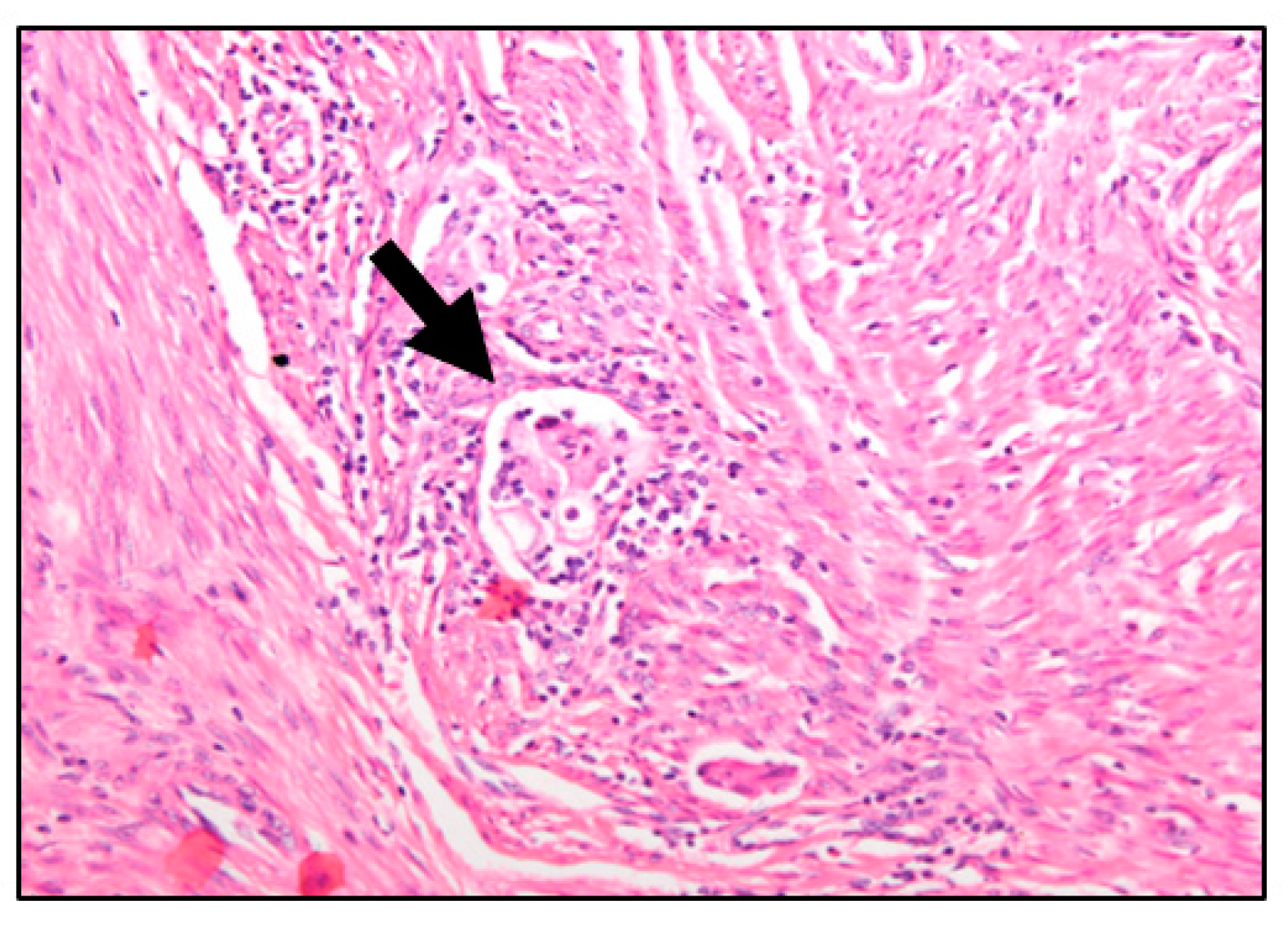 Cancers 15 02612 g001