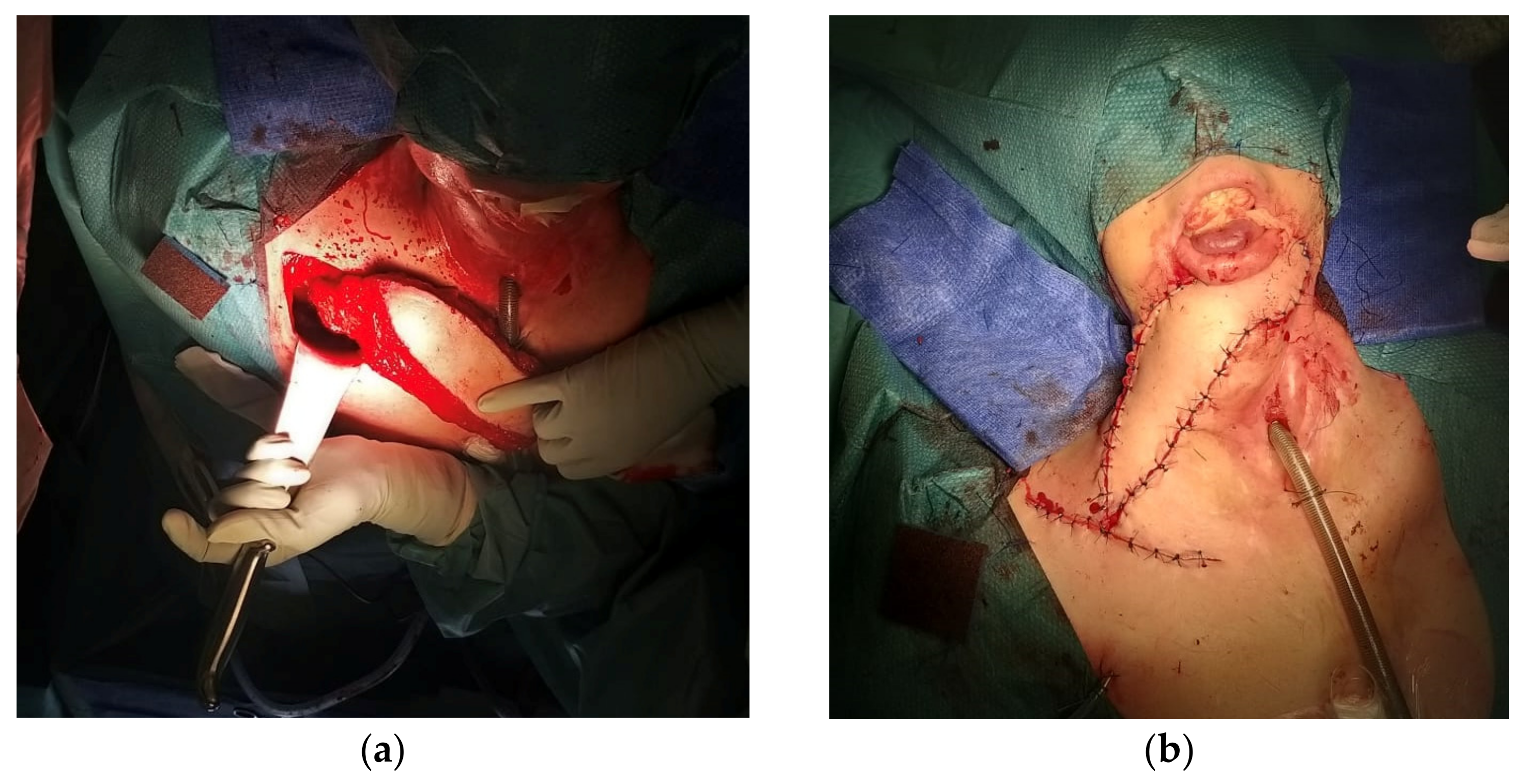 Cancers 15 02625 g002