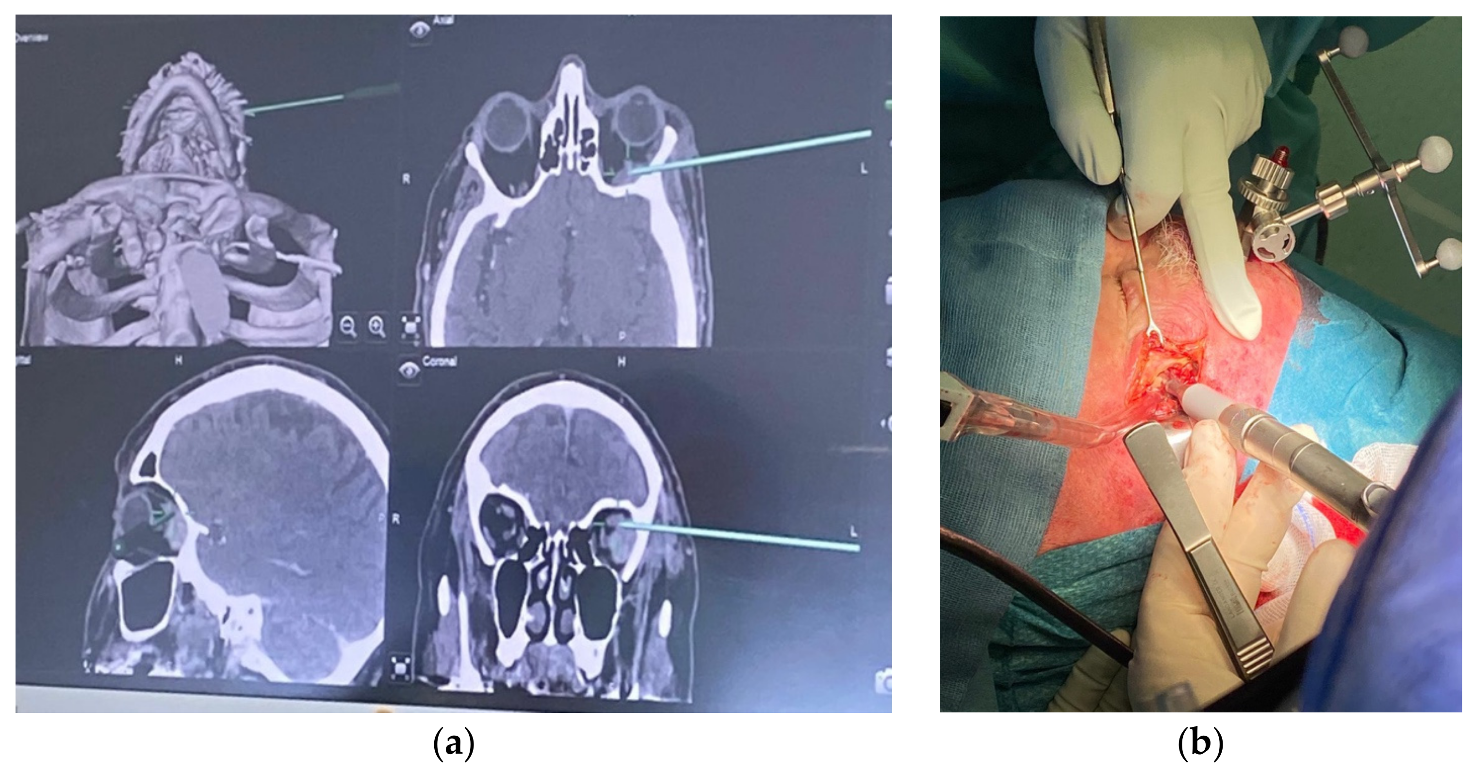 Cancers 15 02625 g003