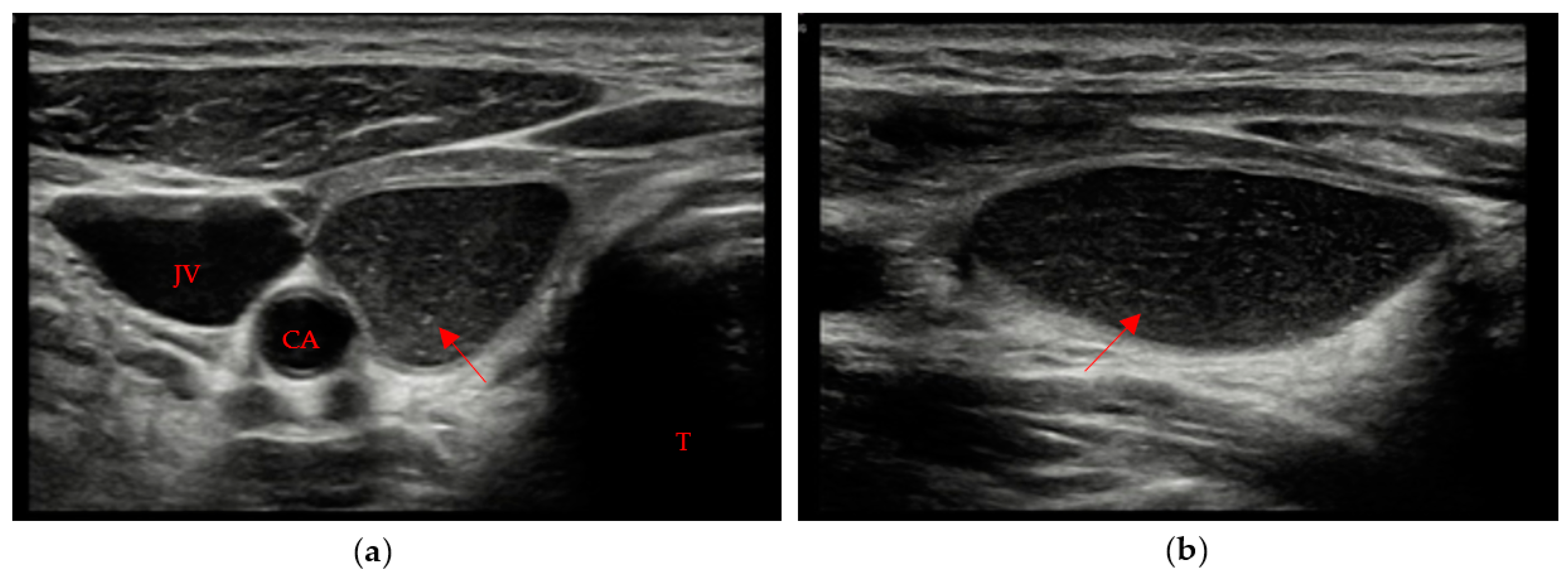 Cancers 15 02644 g001