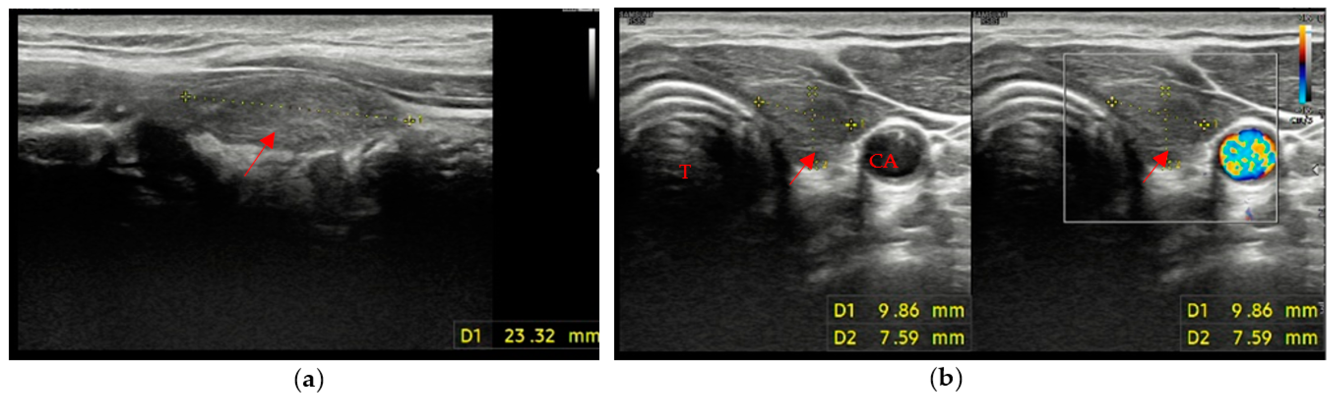 Cancers 15 02644 g002