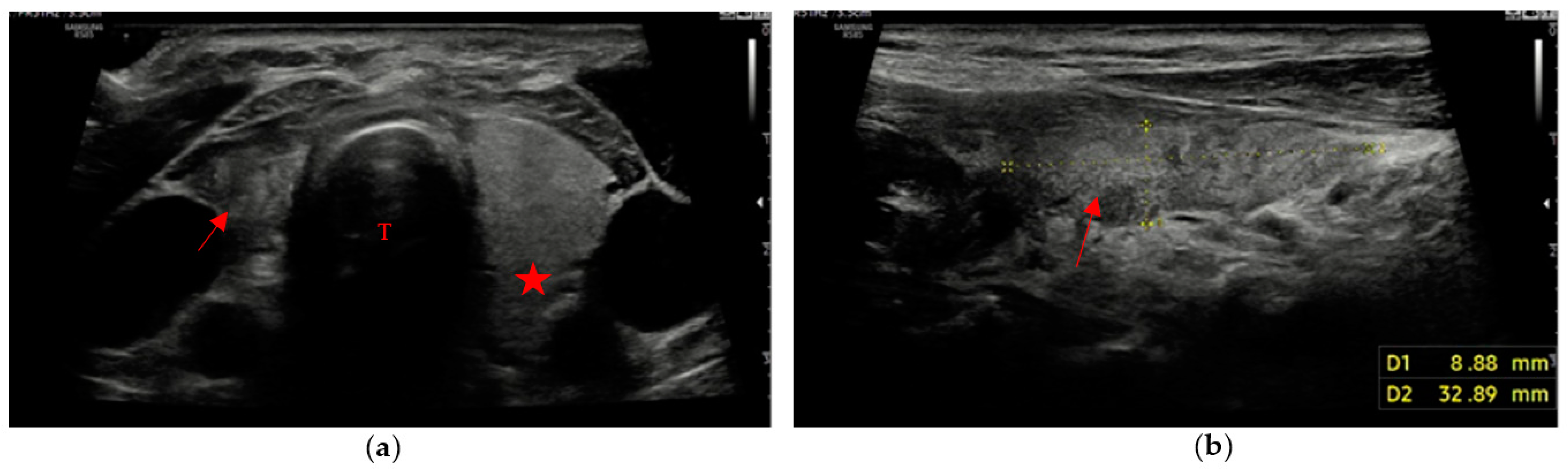 Cancers 15 02644 g003