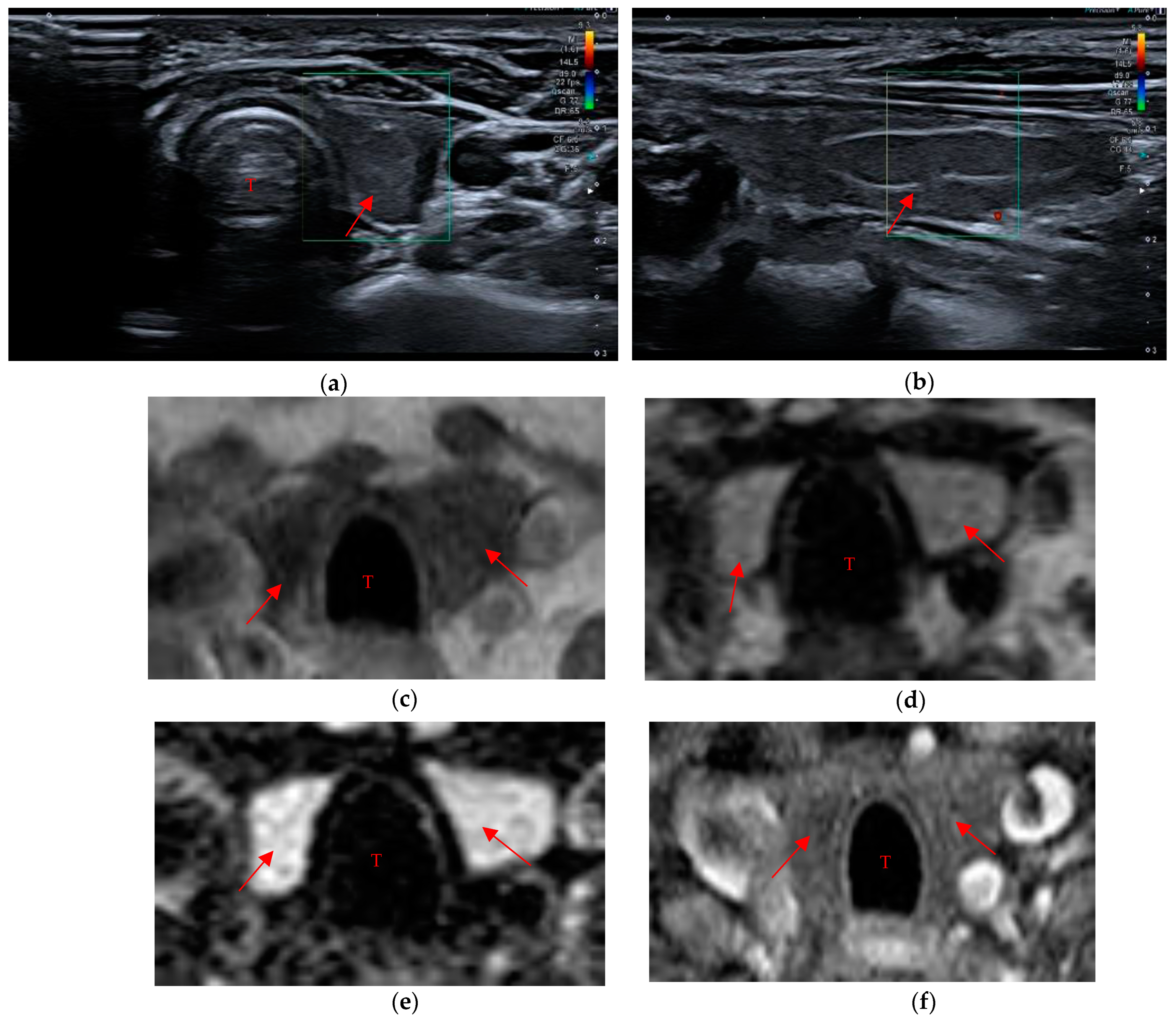 Cancers 15 02644 g005