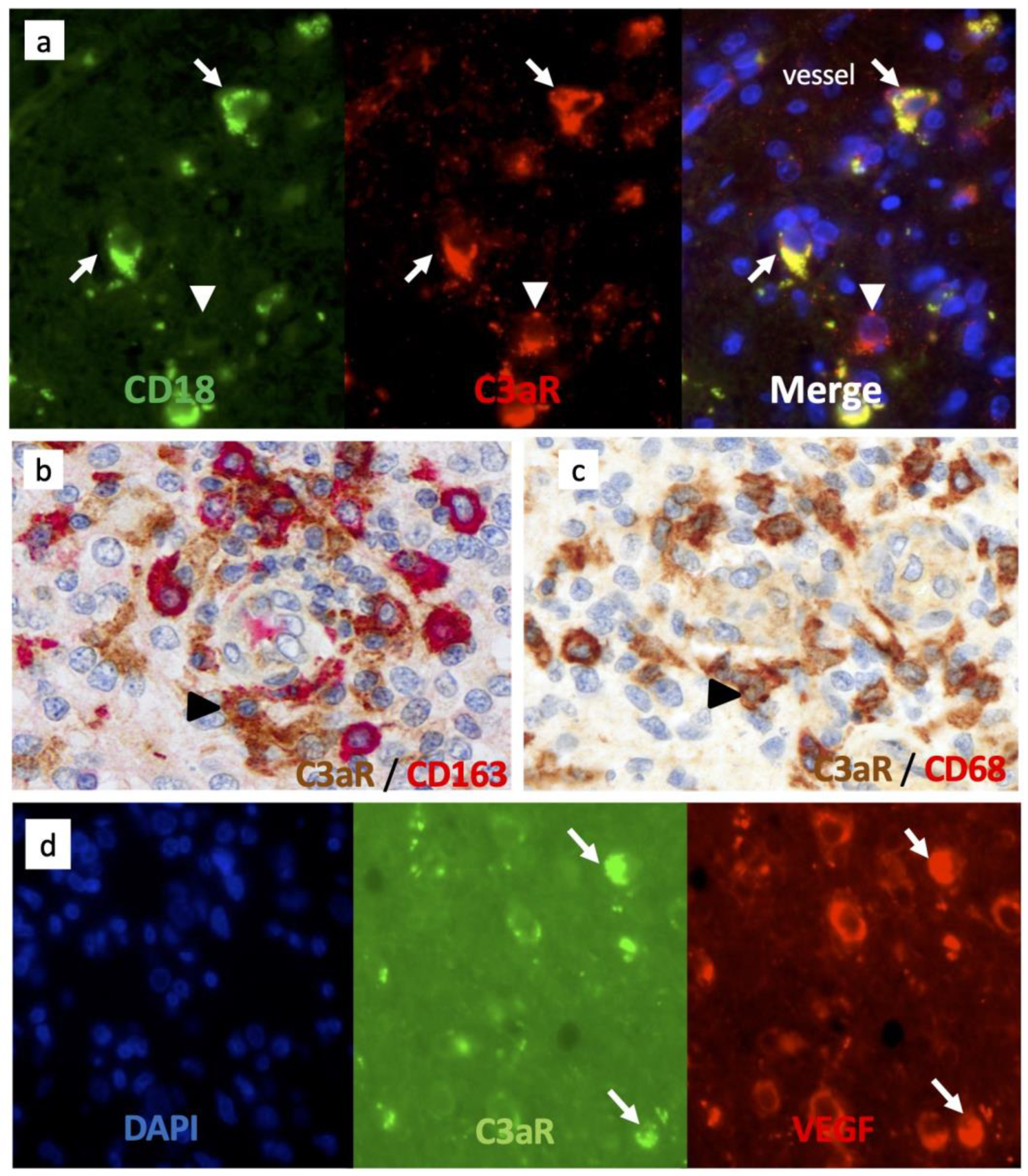 Cancers 15 02647 g004