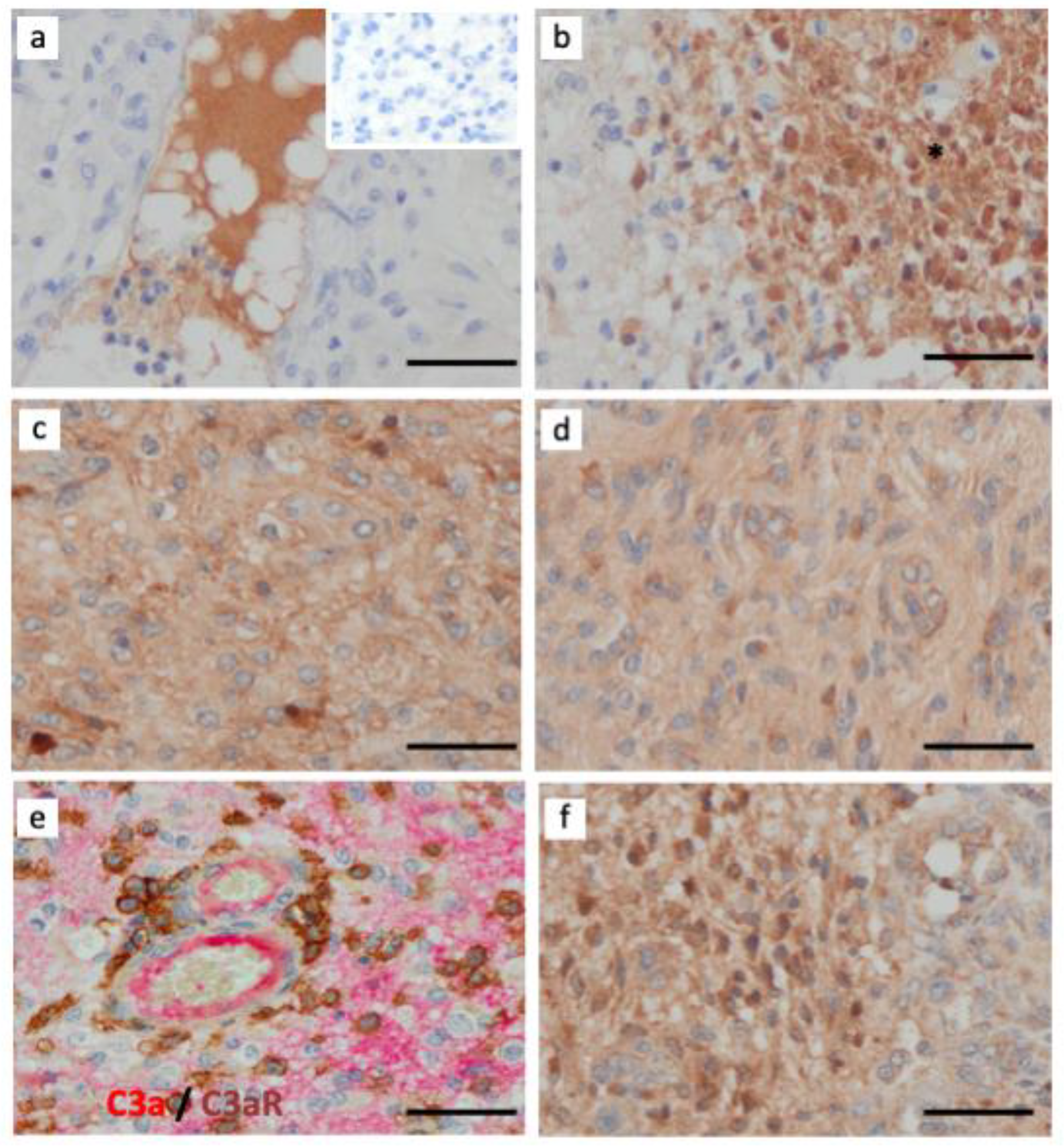 Cancers 15 02647 g006