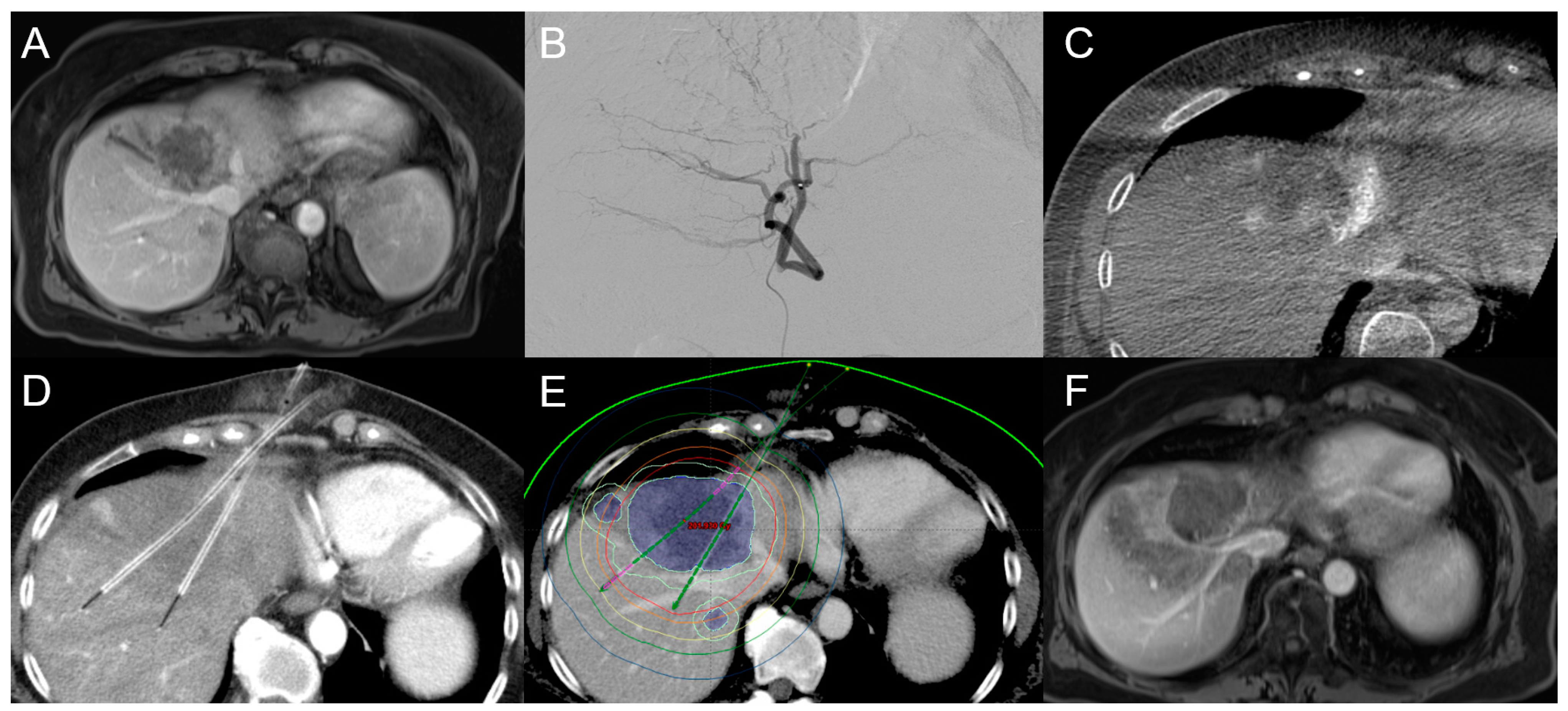 Cancers 15 02655 g005