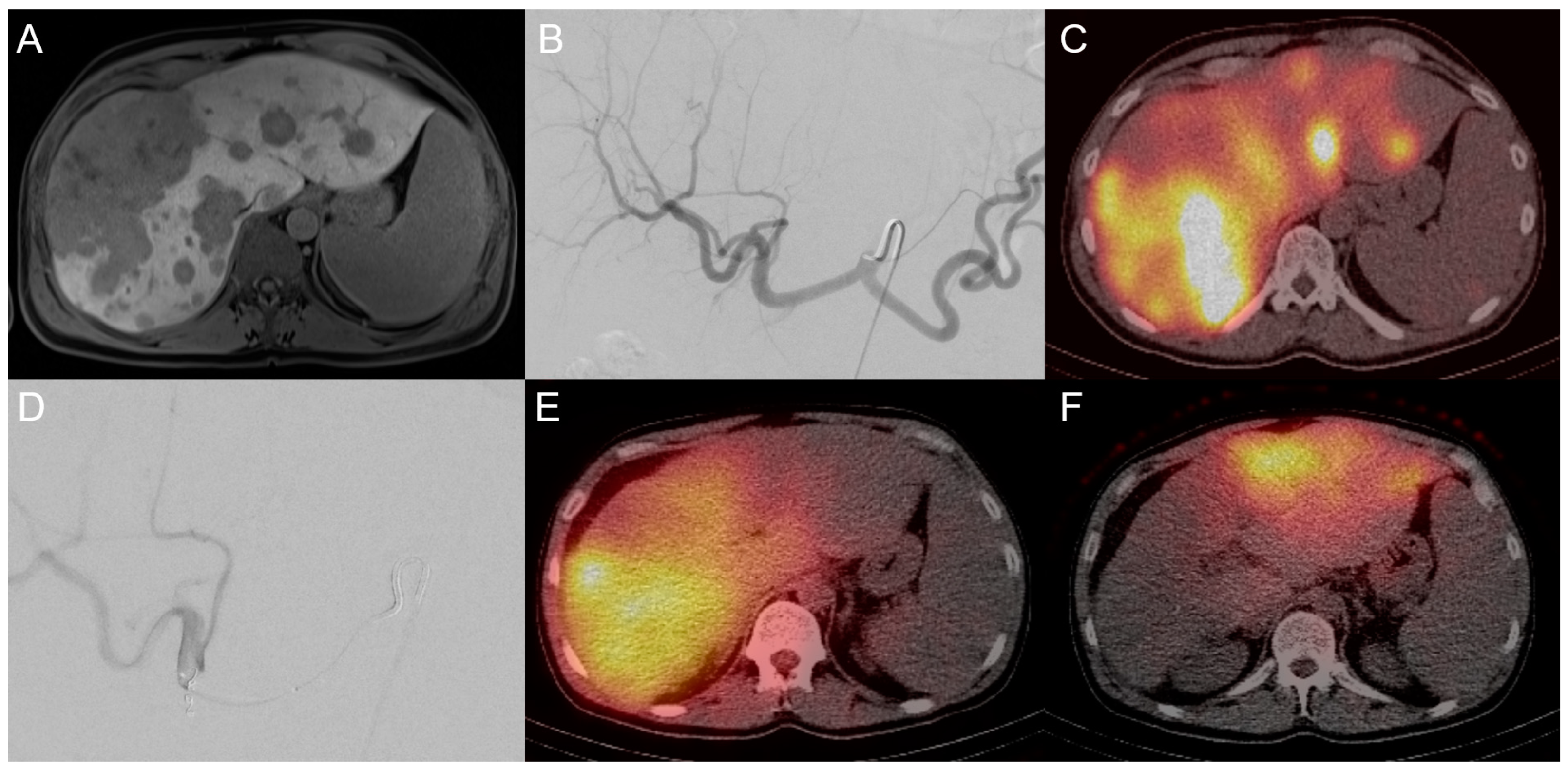 Cancers 15 02655 g006