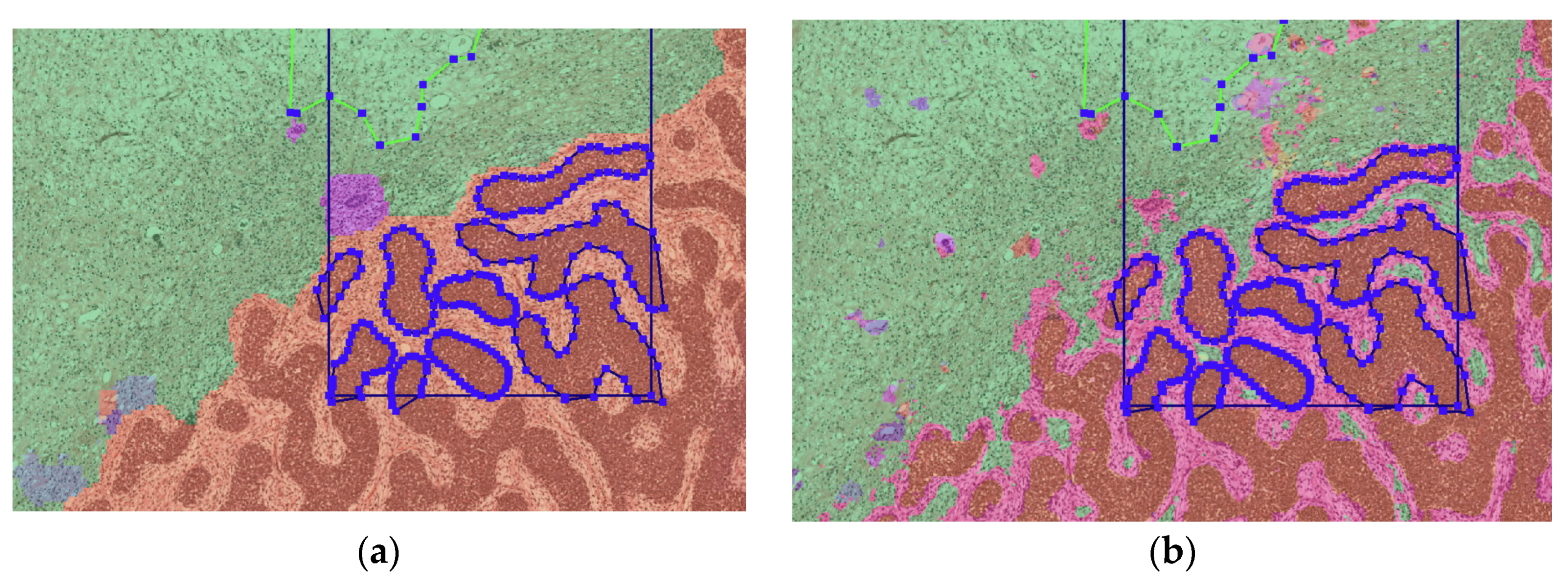 Cancers 15 02656 g002