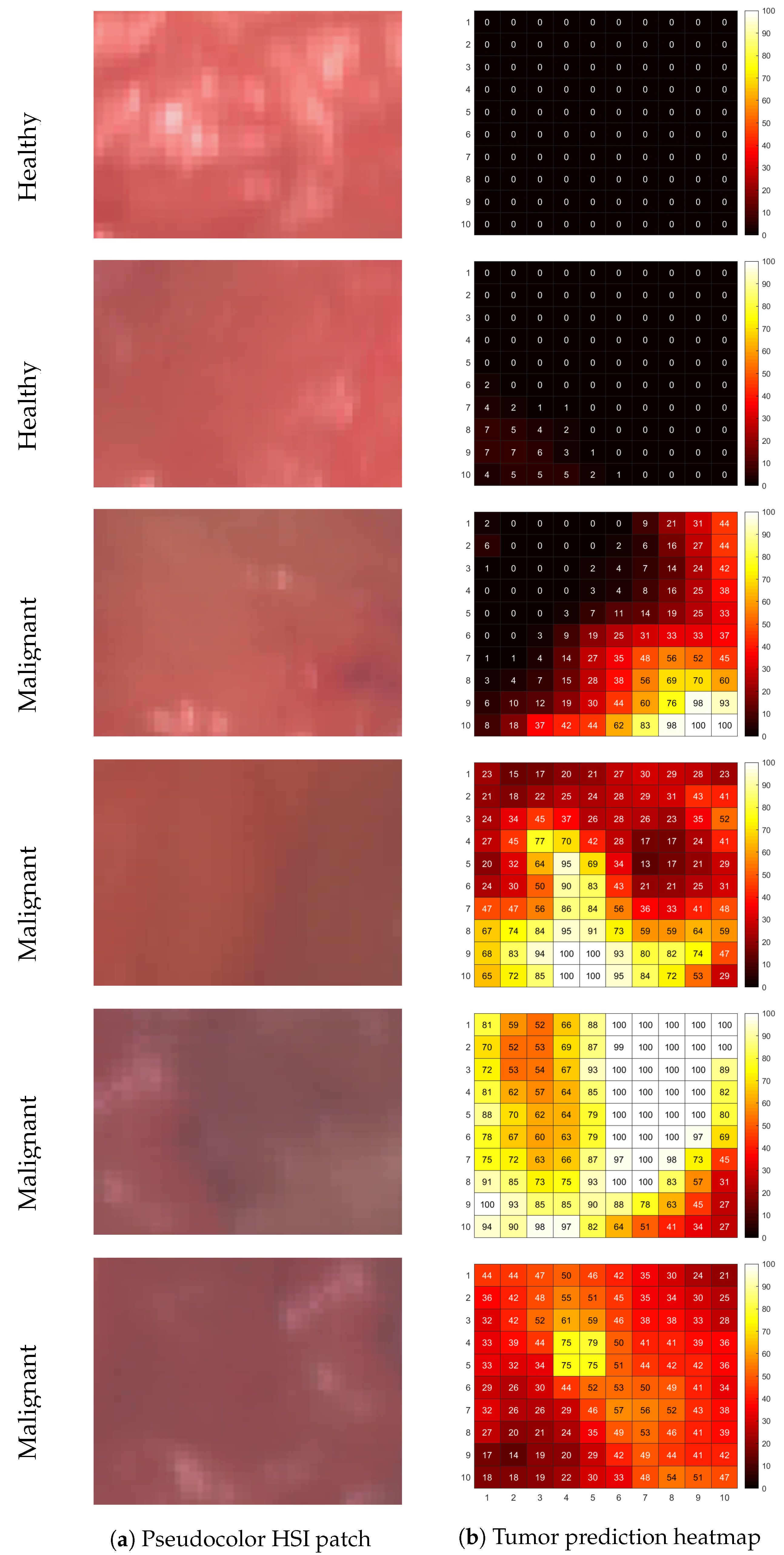 Cancers 15 02679 g004