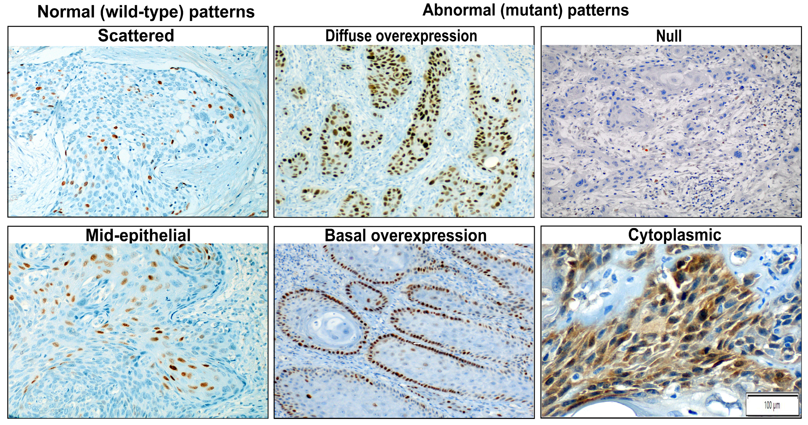 Cancers 15 02719 g001