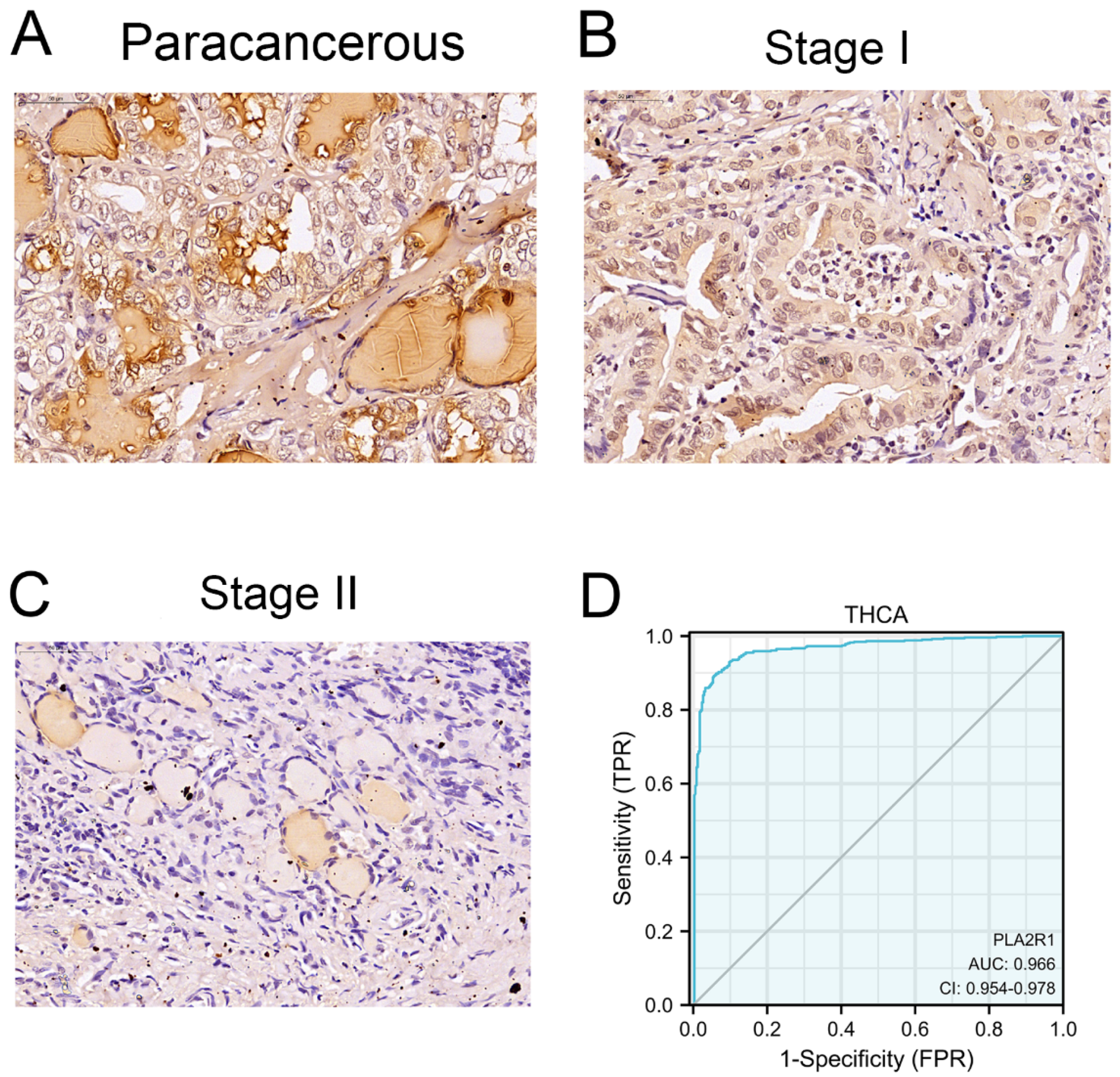 Cancers 15 02720 g002 Cancers 15 02720 g002