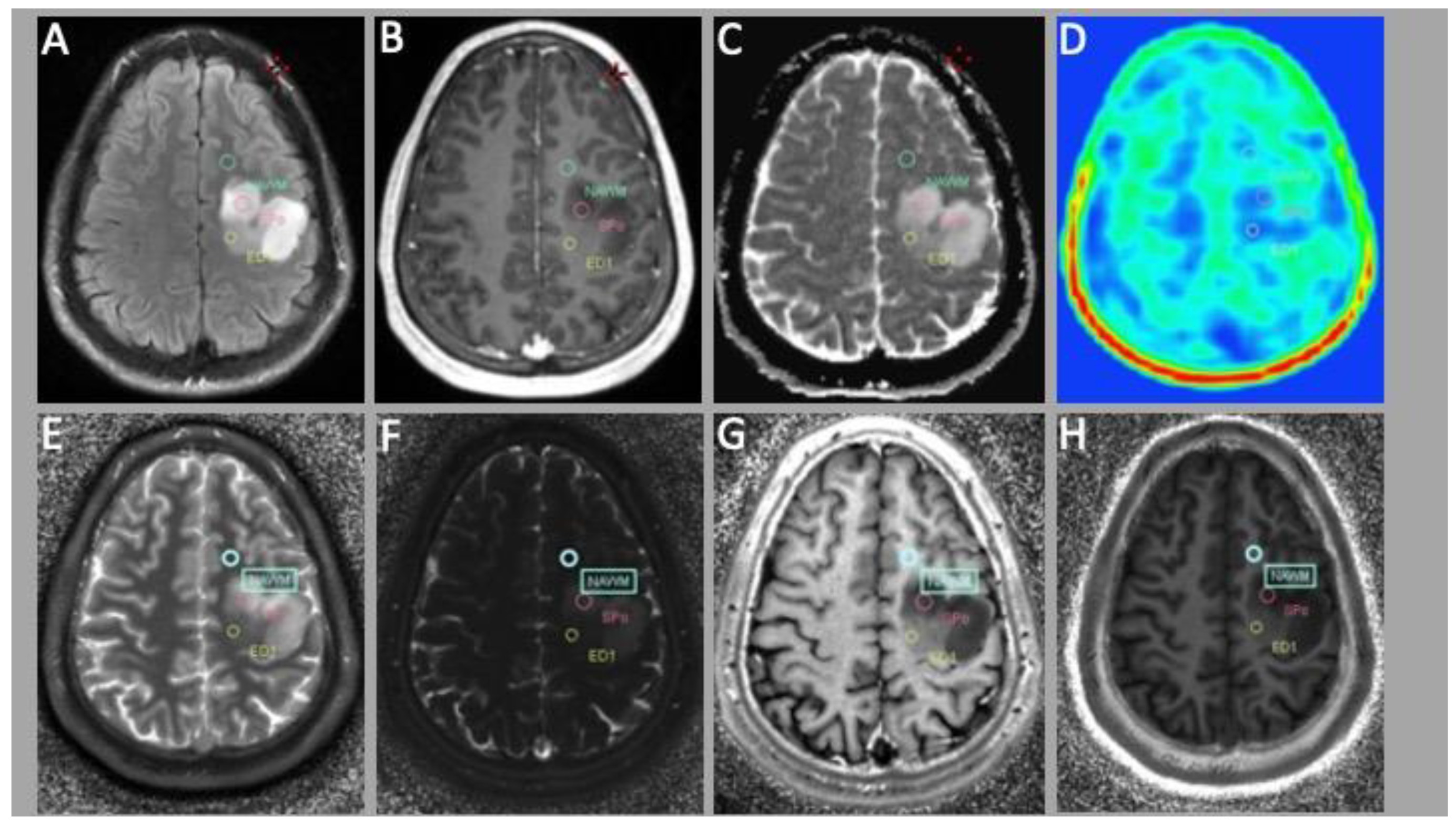 Cancers 15 02740 g001