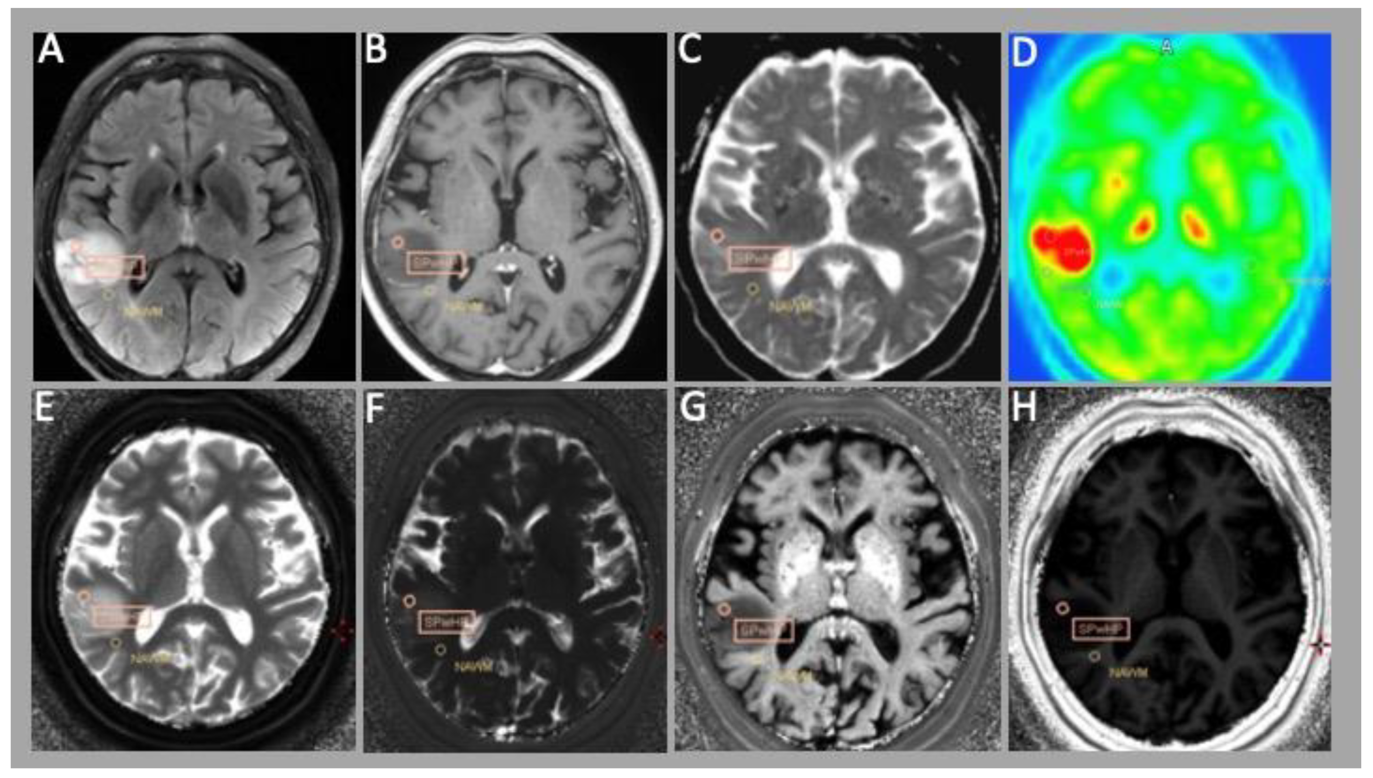 Cancers 15 02740 g002