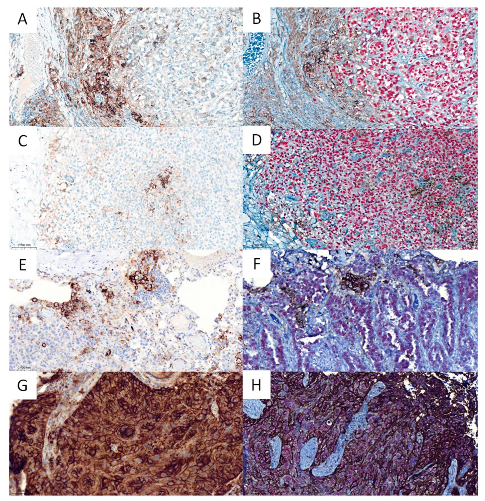 Cancers 15 02768 g003