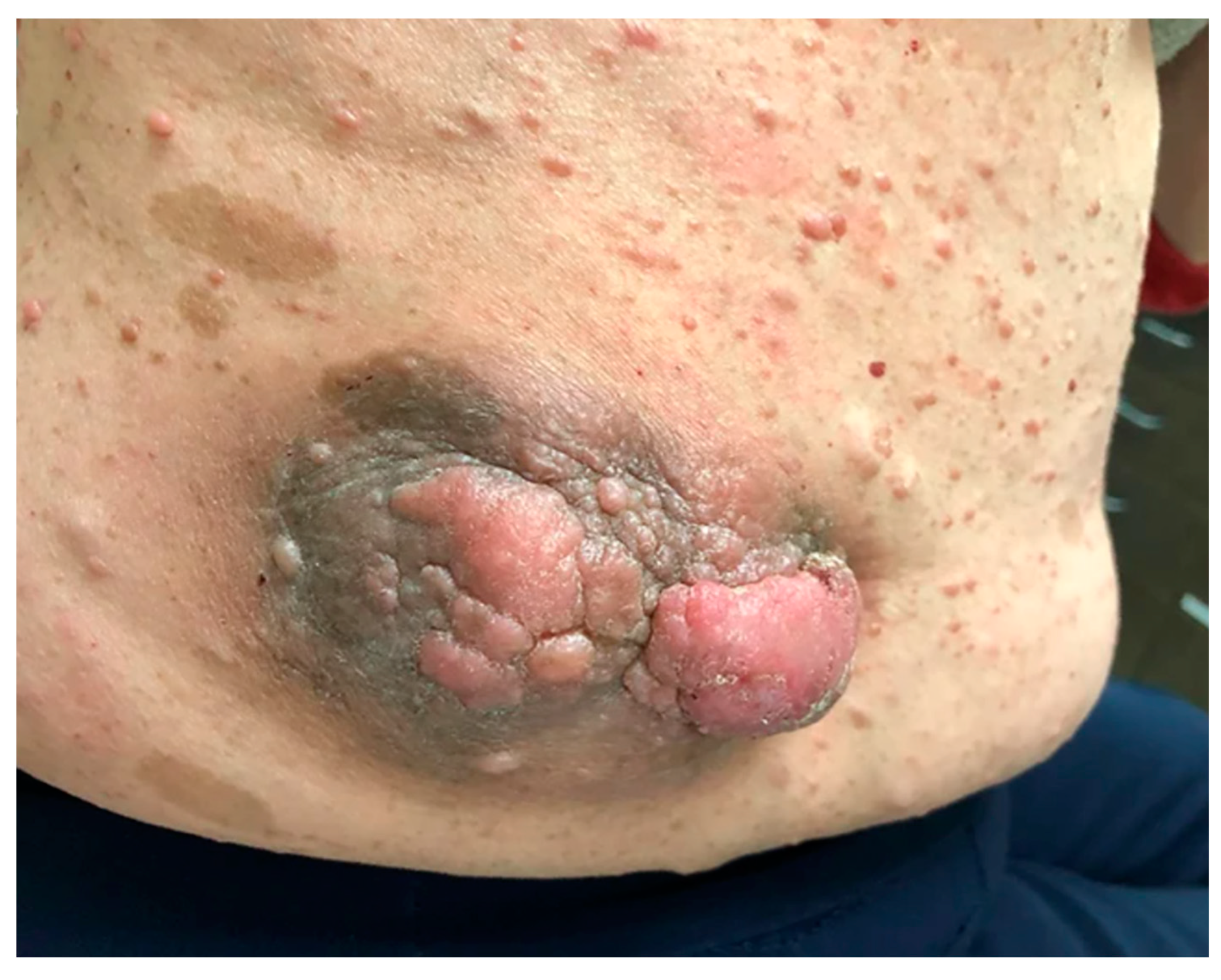 Cancers 15 02770 g002