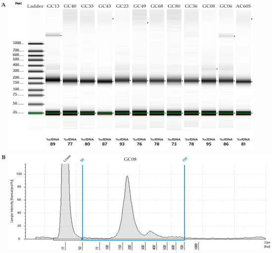 Cancers 15 02783 g0a1