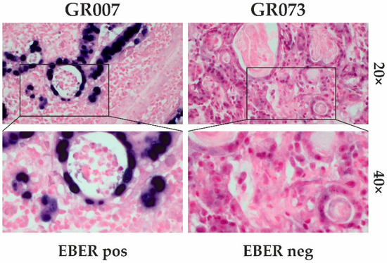 Cancers 15 02783 g0a2