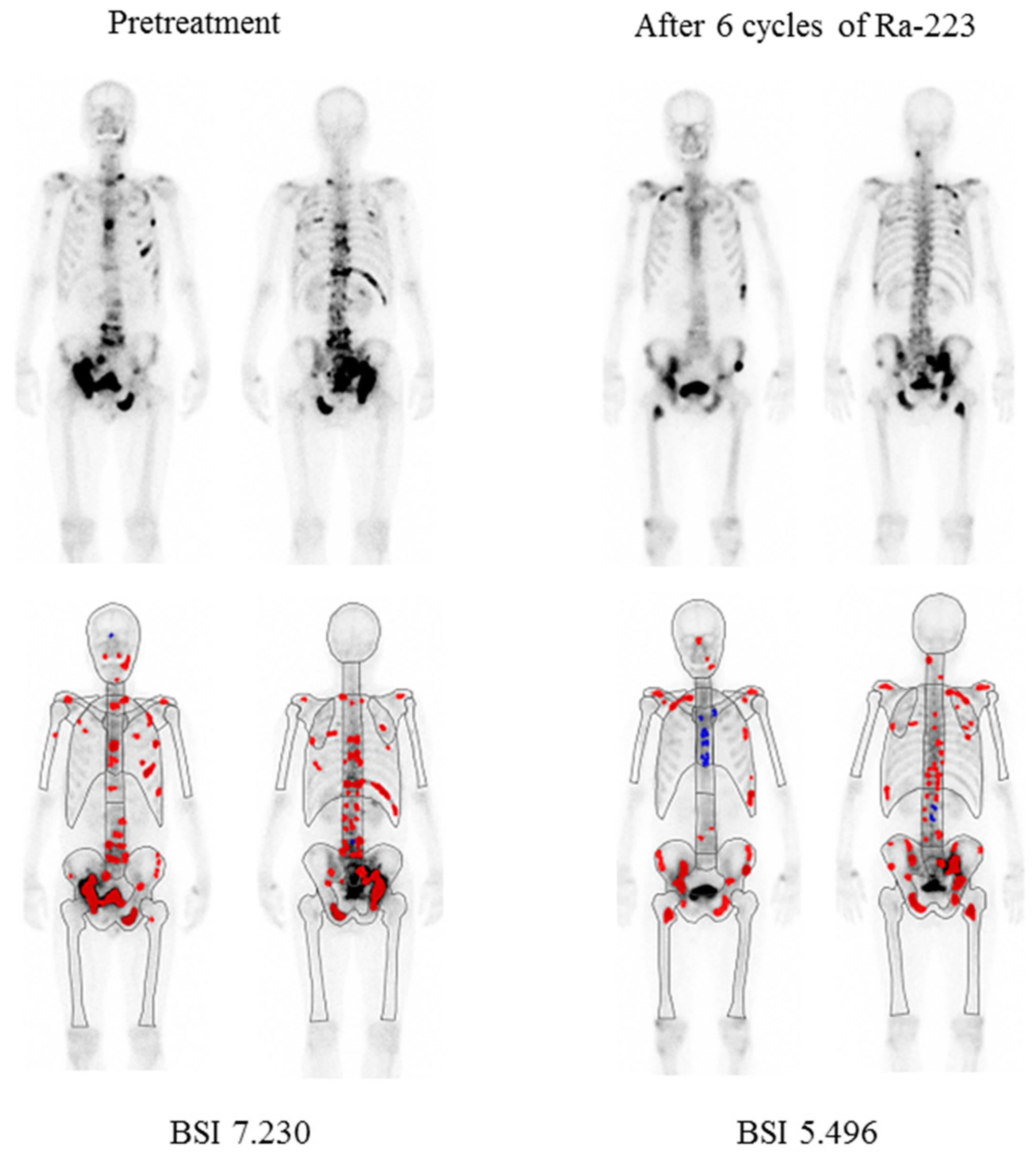 Cancers 15 02784 g001