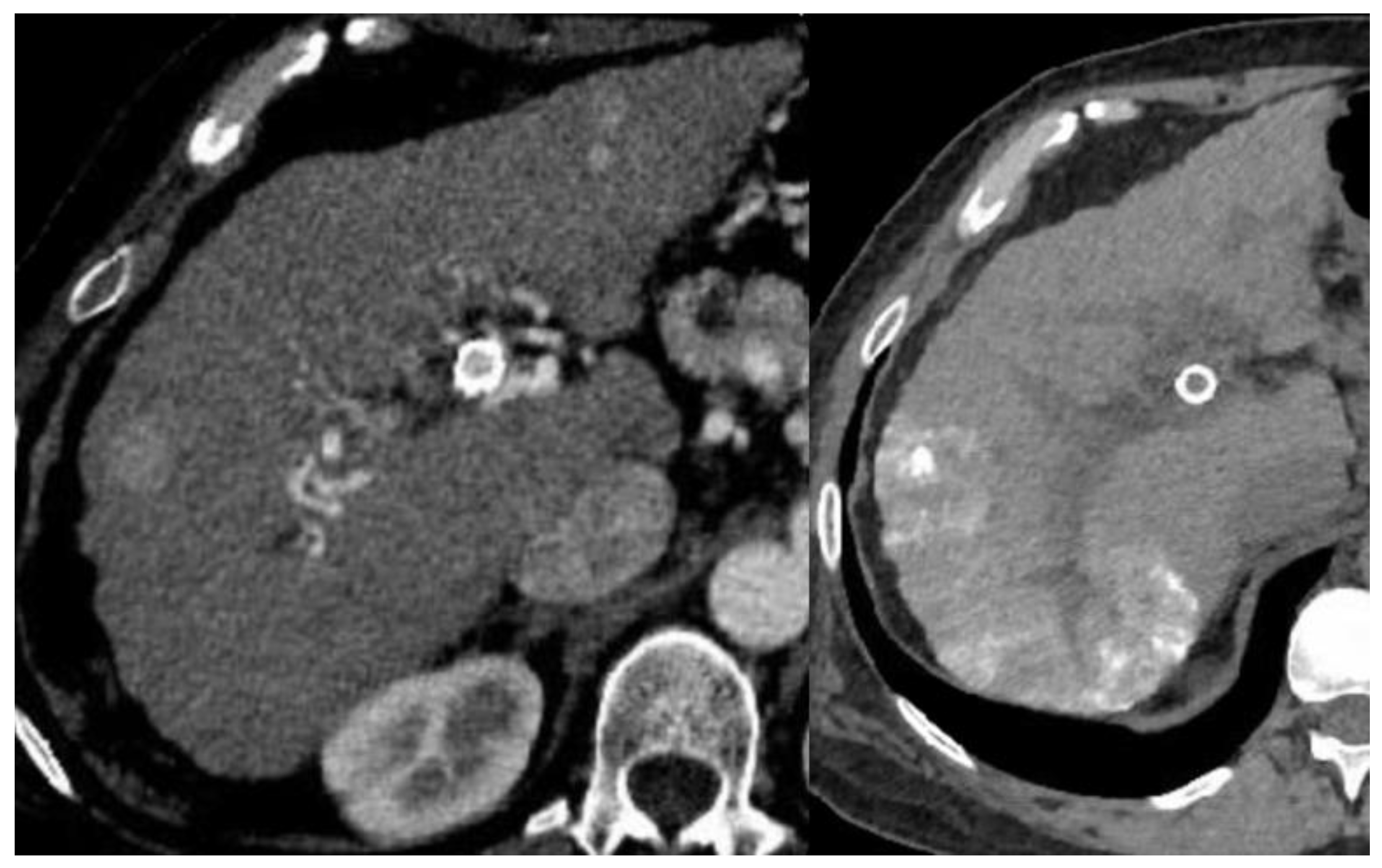 Cancers 15 02791 g001 Cancers 15 02791 g001