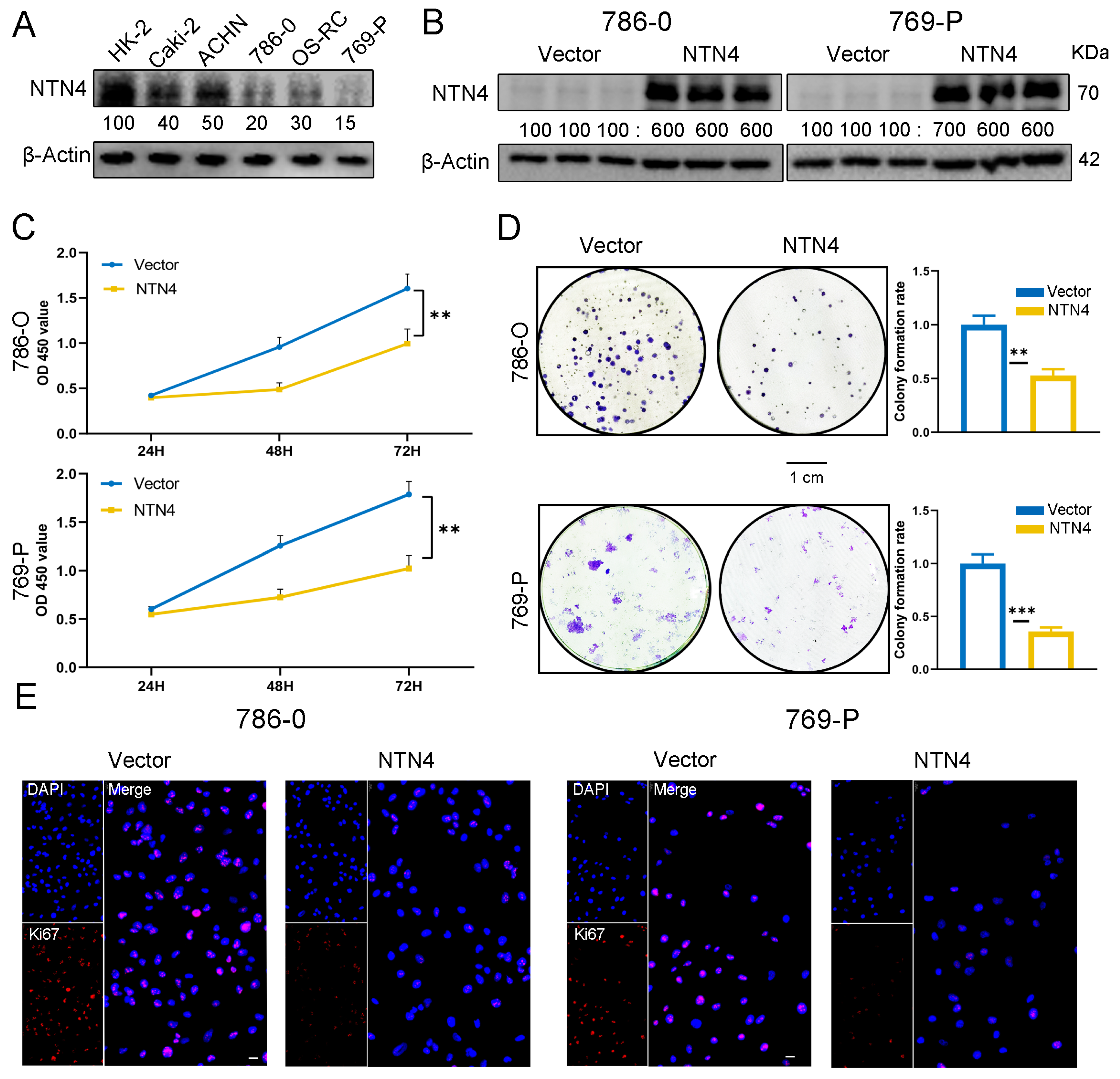 Cancers 15 02816 g005