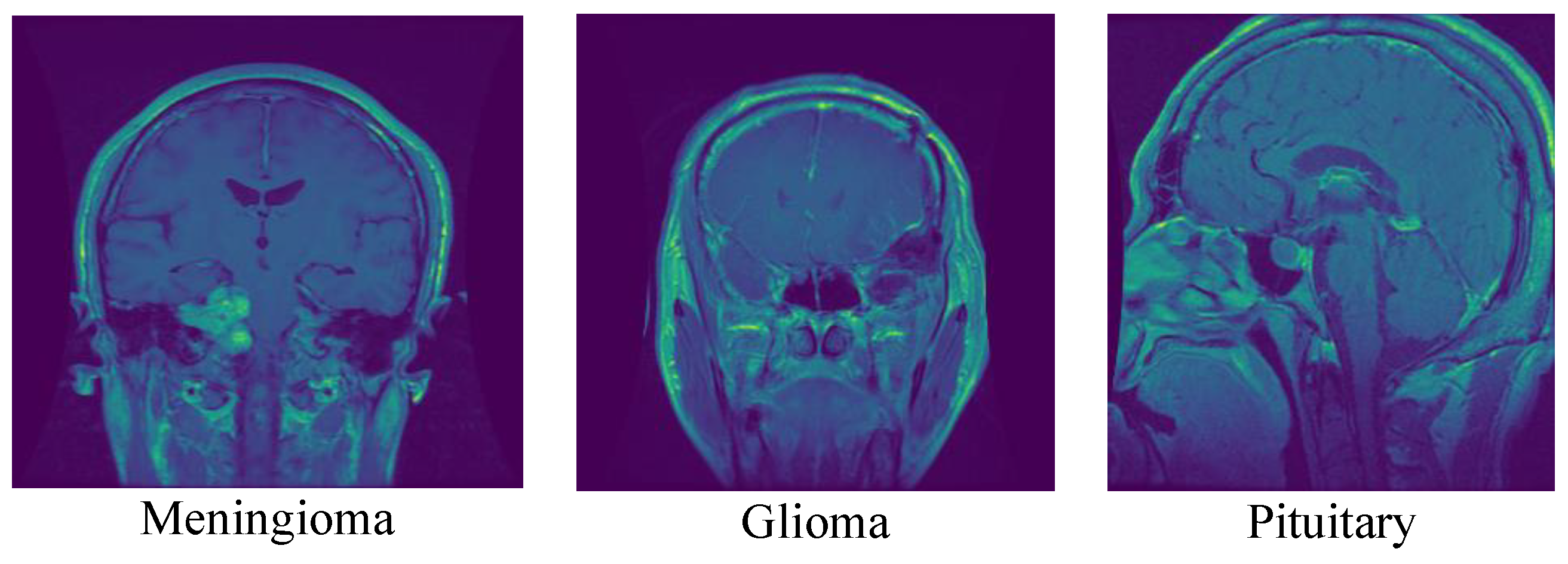 Cancers 15 02837 g003