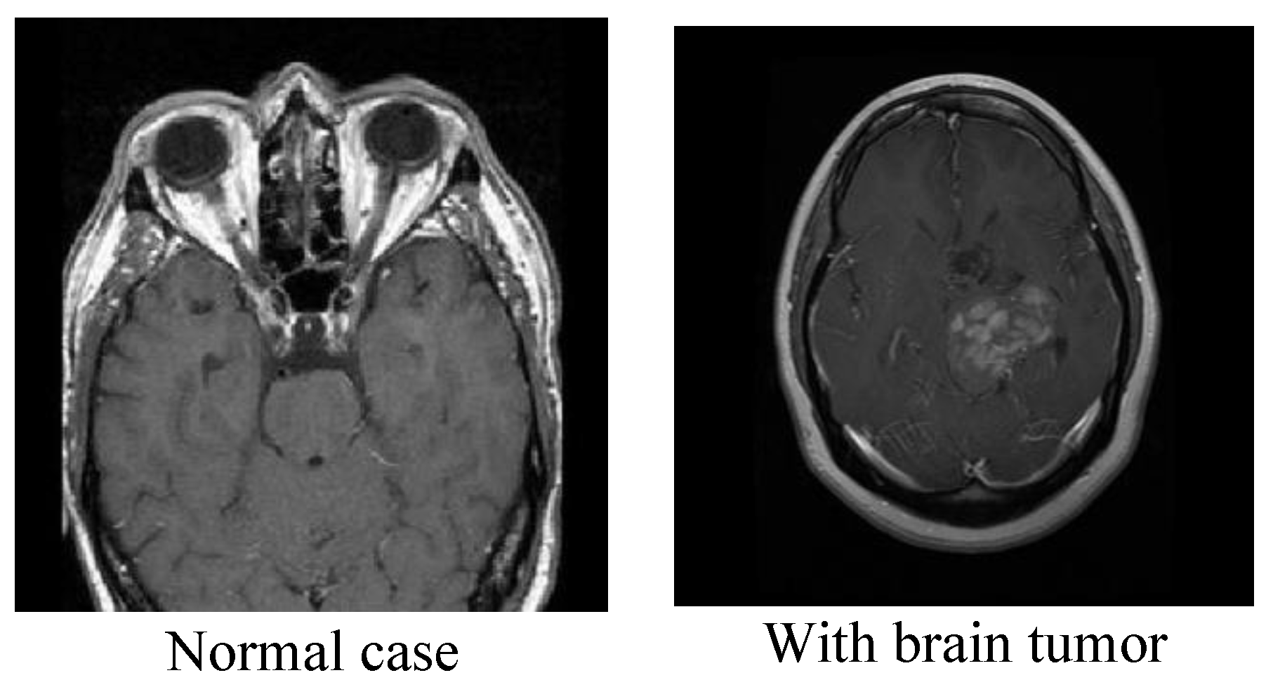 Cancers 15 02837 g004